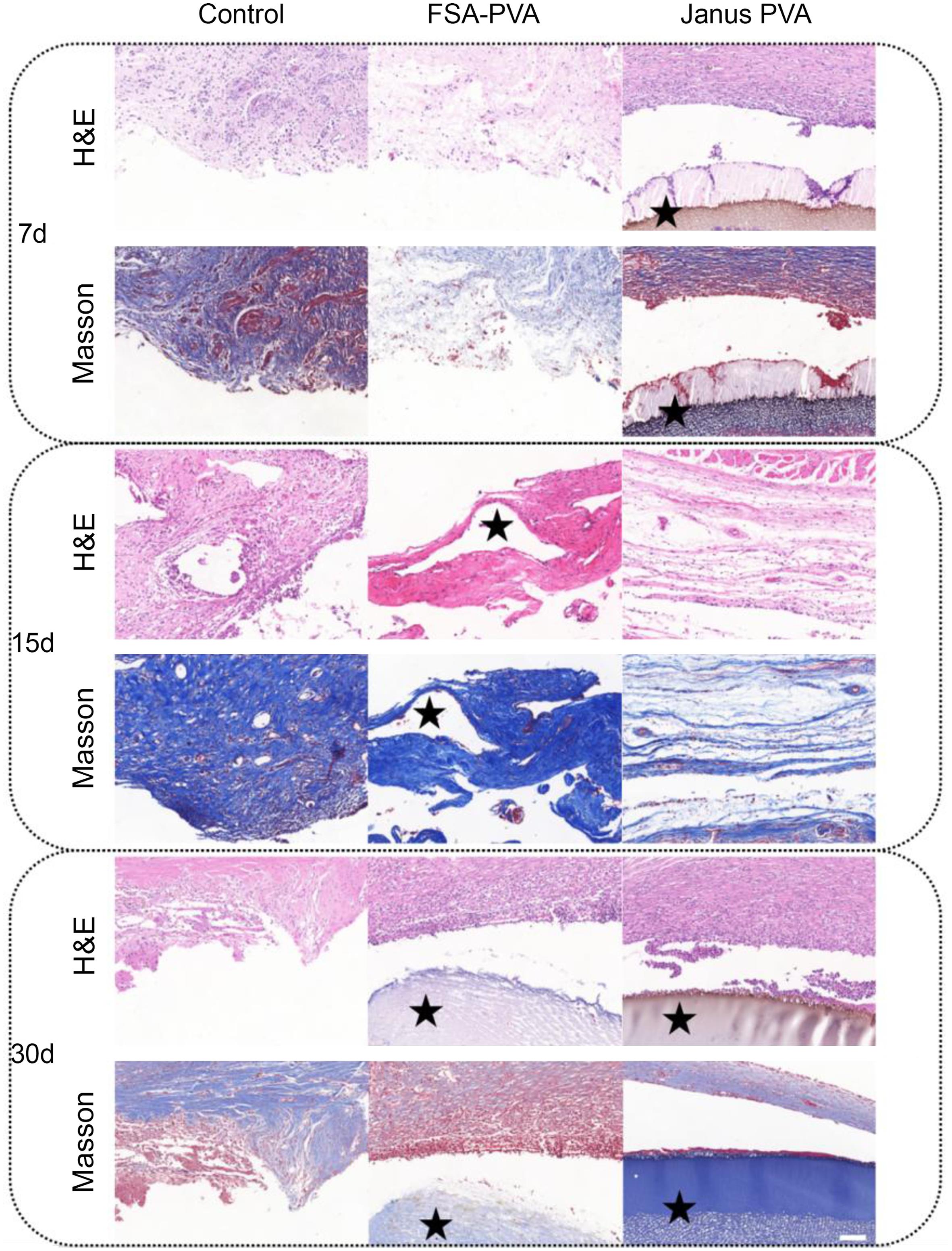 Histological sections of the rat dural defect model.