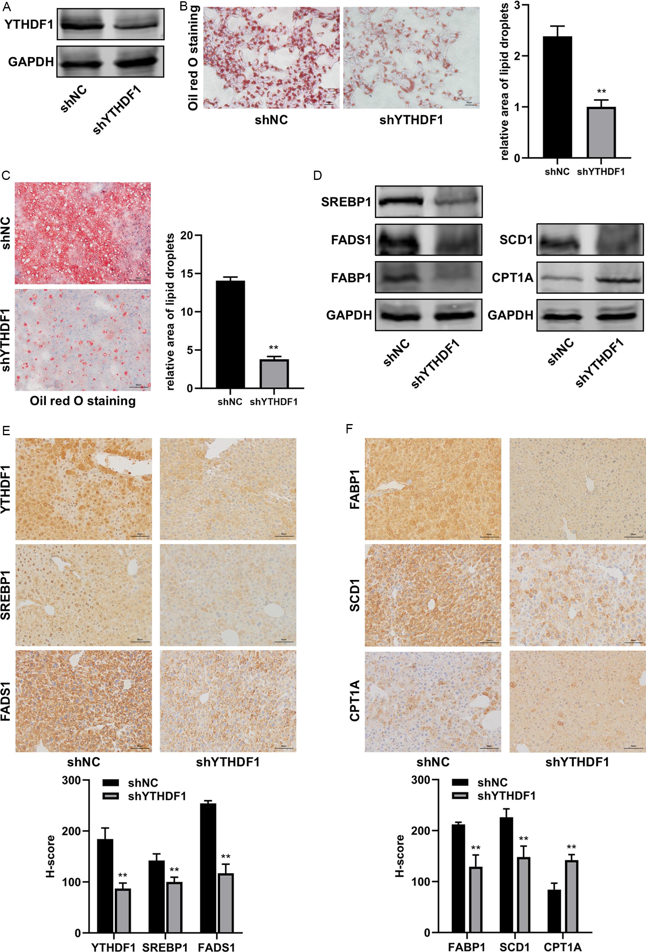 Effect of YTHDF1 silencing on hepatic steatosis and lipid metabolism.