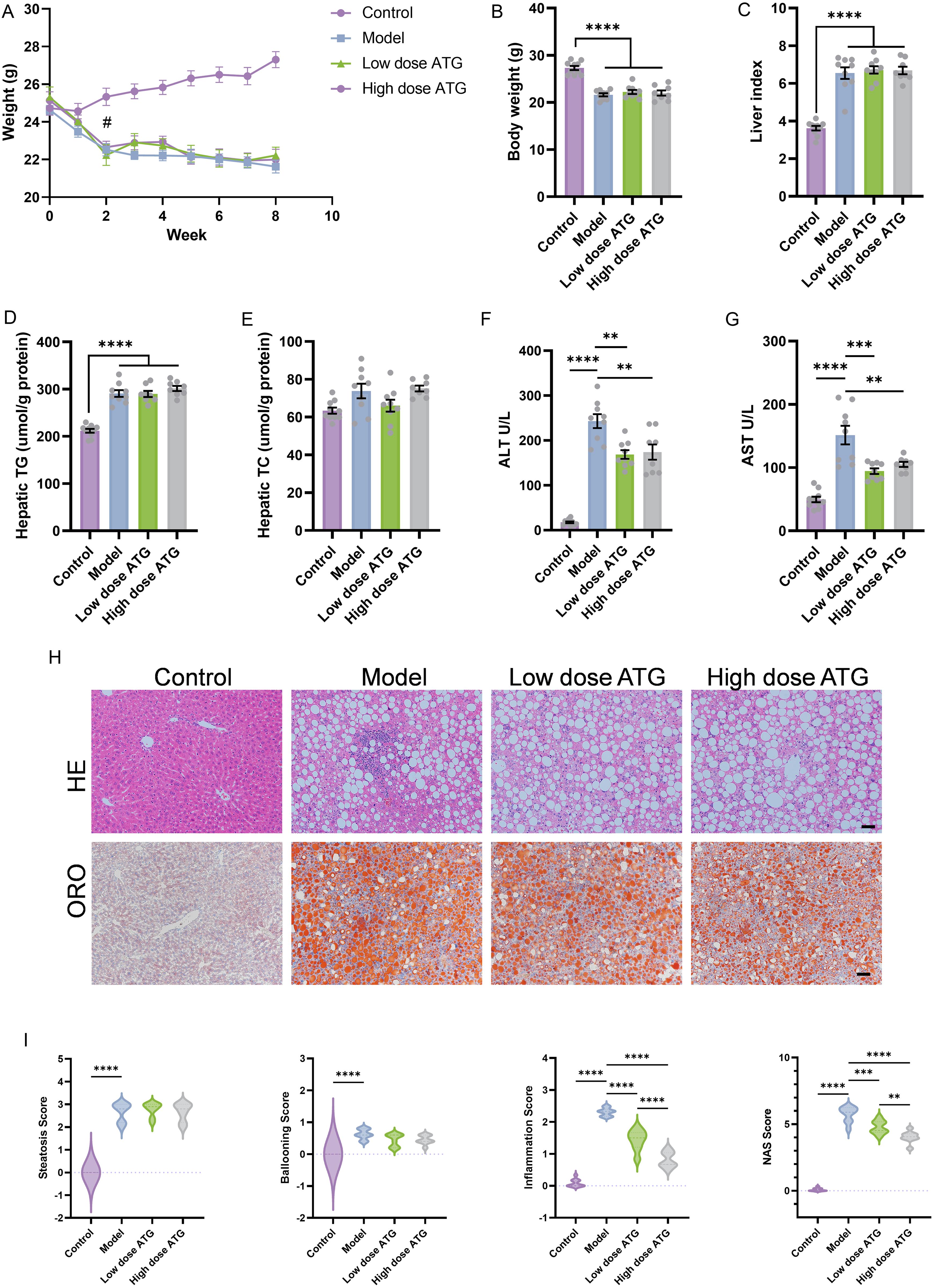 Effects of ATG on MASH induced by choline-deficient, L-amino acid-defined, high-fat diet.