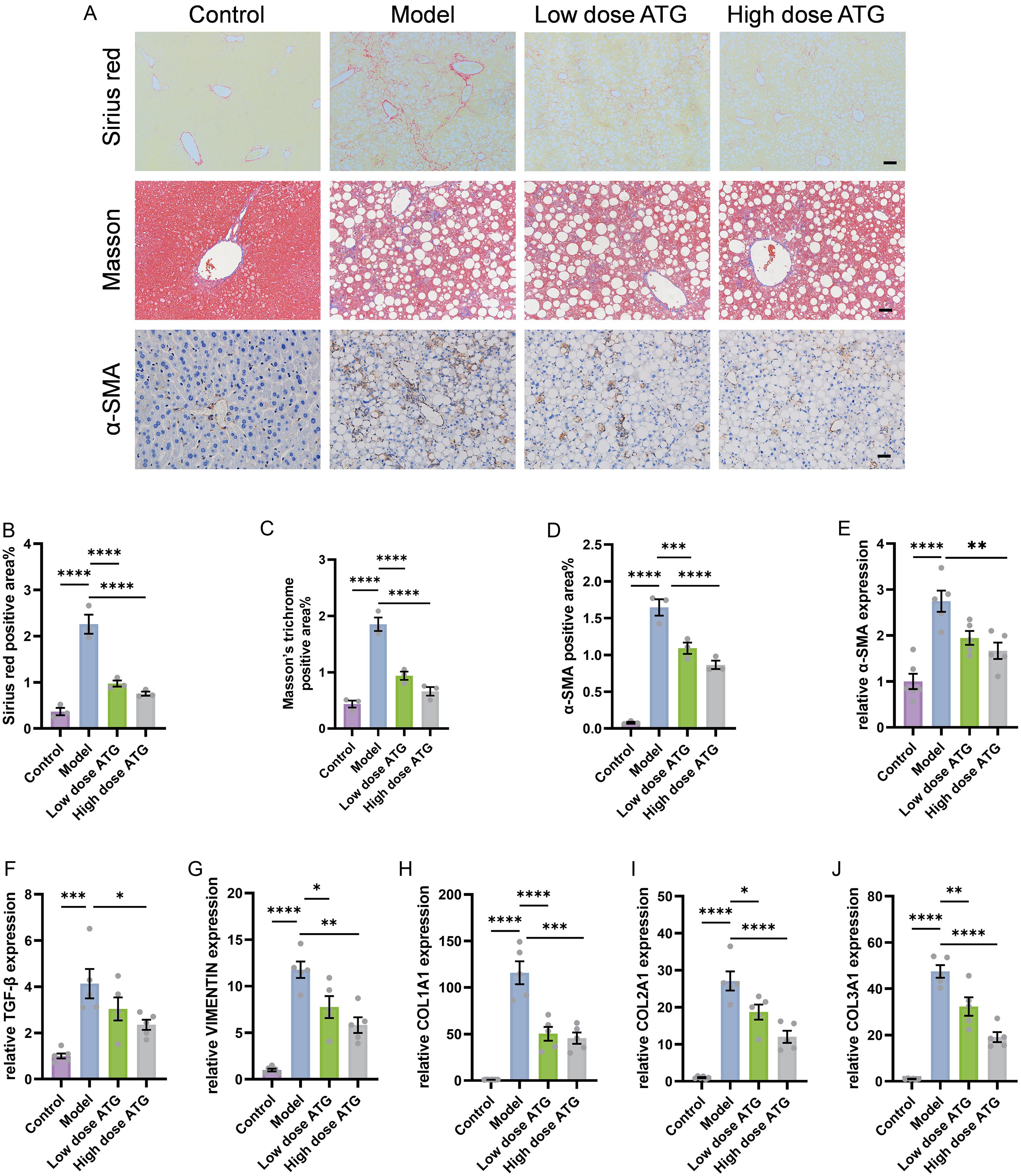 Effects of ATG on liver fibrosis induced by CDAHFD.