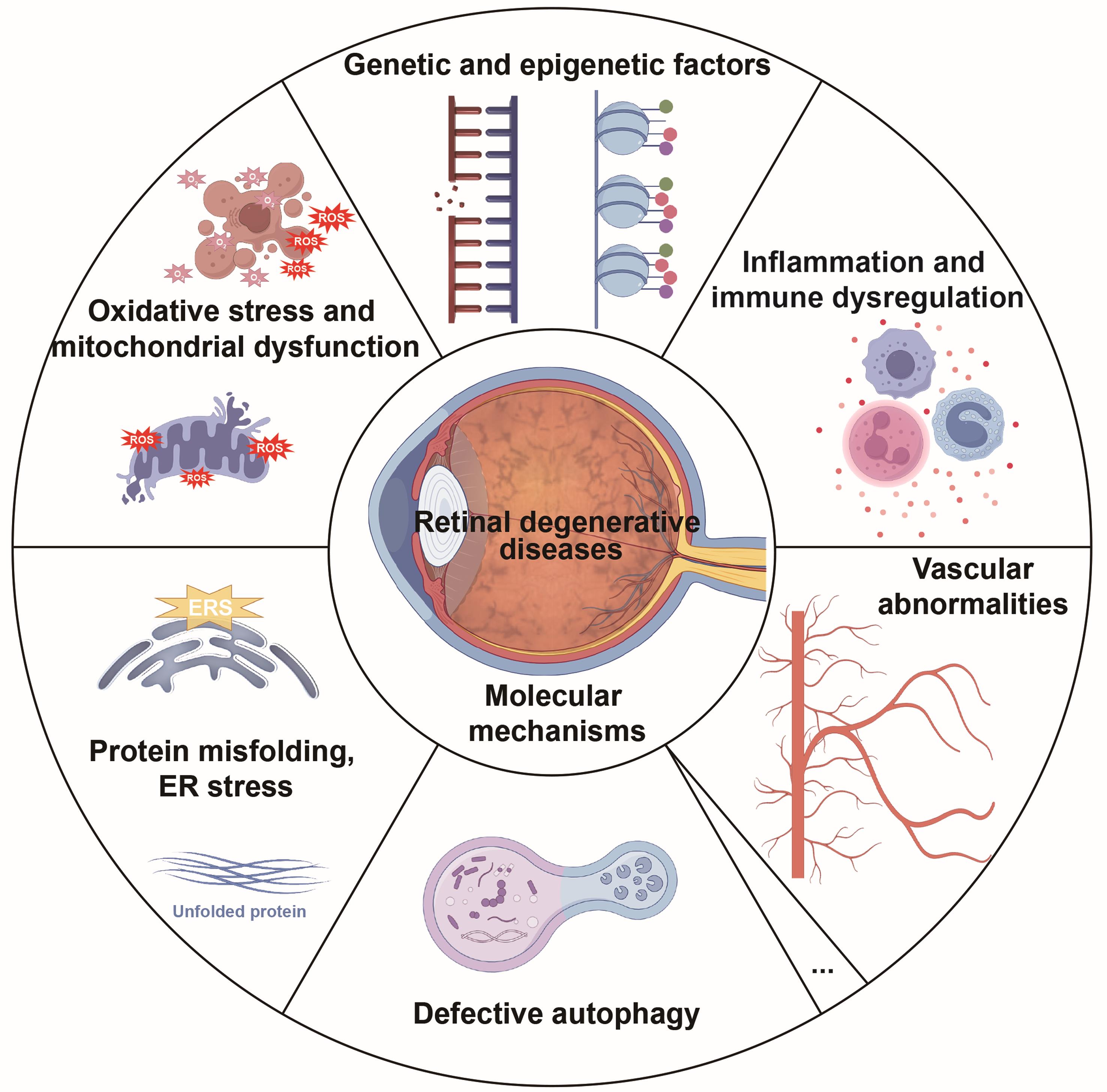 Schematic illustration of the molecular mechanisms underlying retinal degenerative diseases (RDDs). Schematic illustration of the molecular mechanisms underlying retinal degenerative diseases (RDDs).