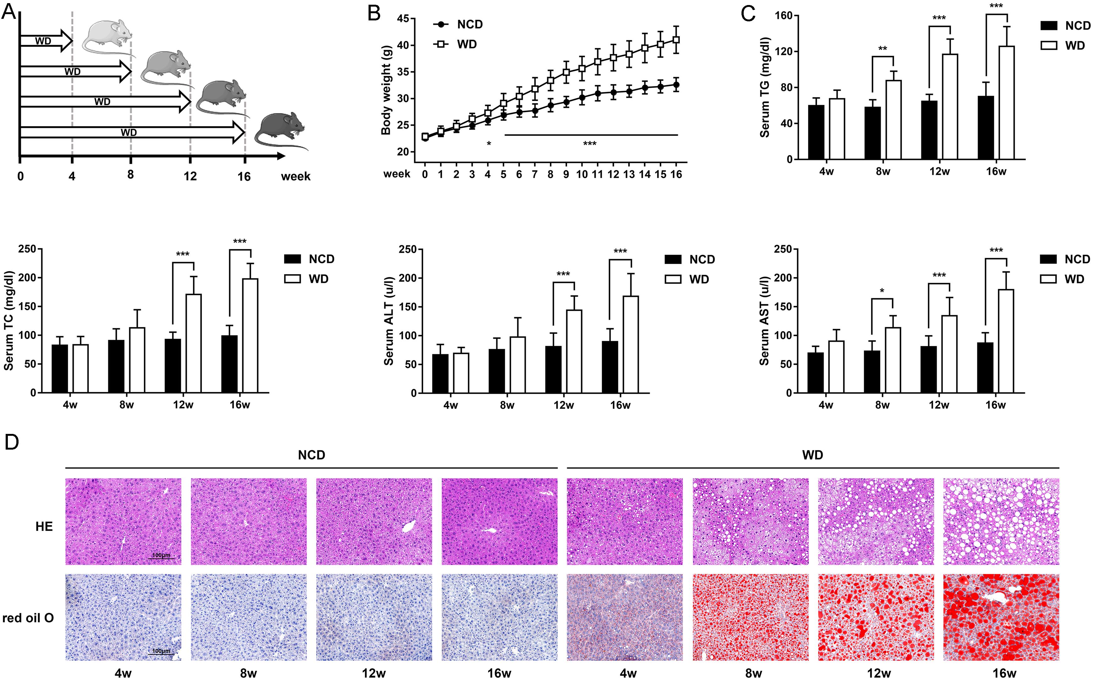 Characteristics of MASLD mouse induced by WD.