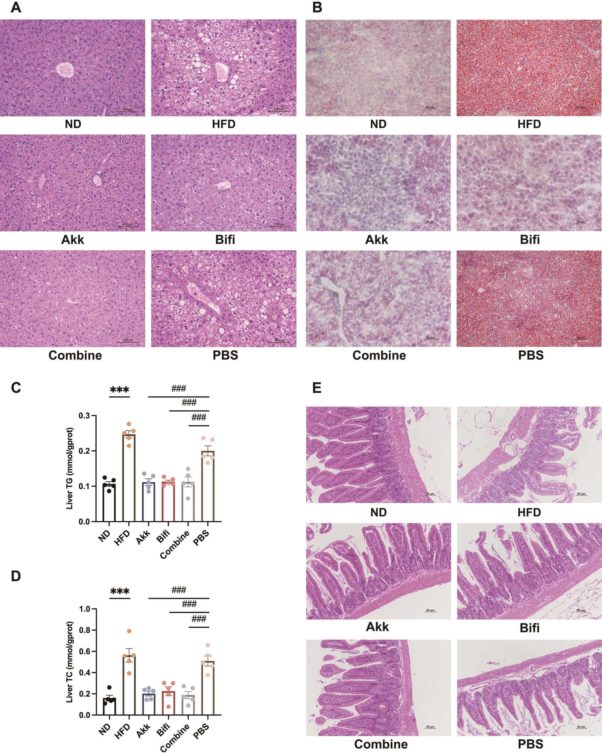 Effect of administration of <italic>A. muciniphila</italic> or <italic>B. bifidum</italic> on hepatic steatosis and intestinal barrier function in mice.