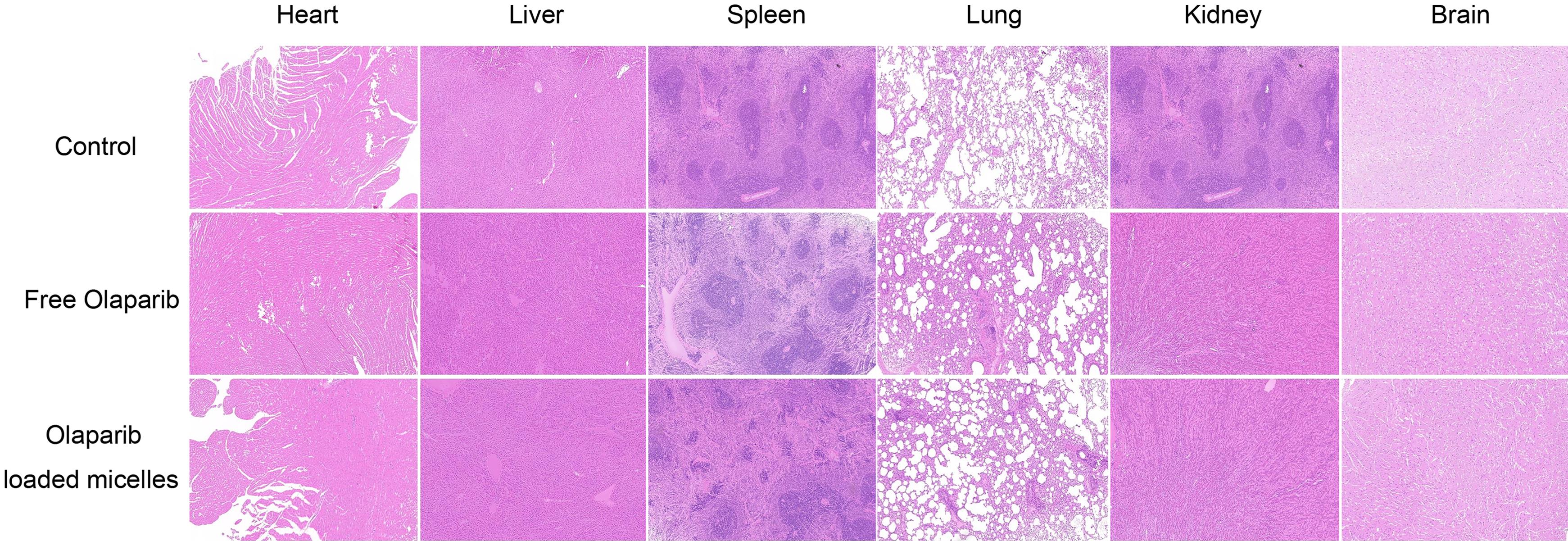 Evaluation of side effects: H&E staining of the heart, liver, spleen, lung, kidneys and brain obtained from rats treated with PBS (control), free olaparib, and olaparib-loaded micelles (initial polymer concentration of 30 mg/mL, magnification: ×200).