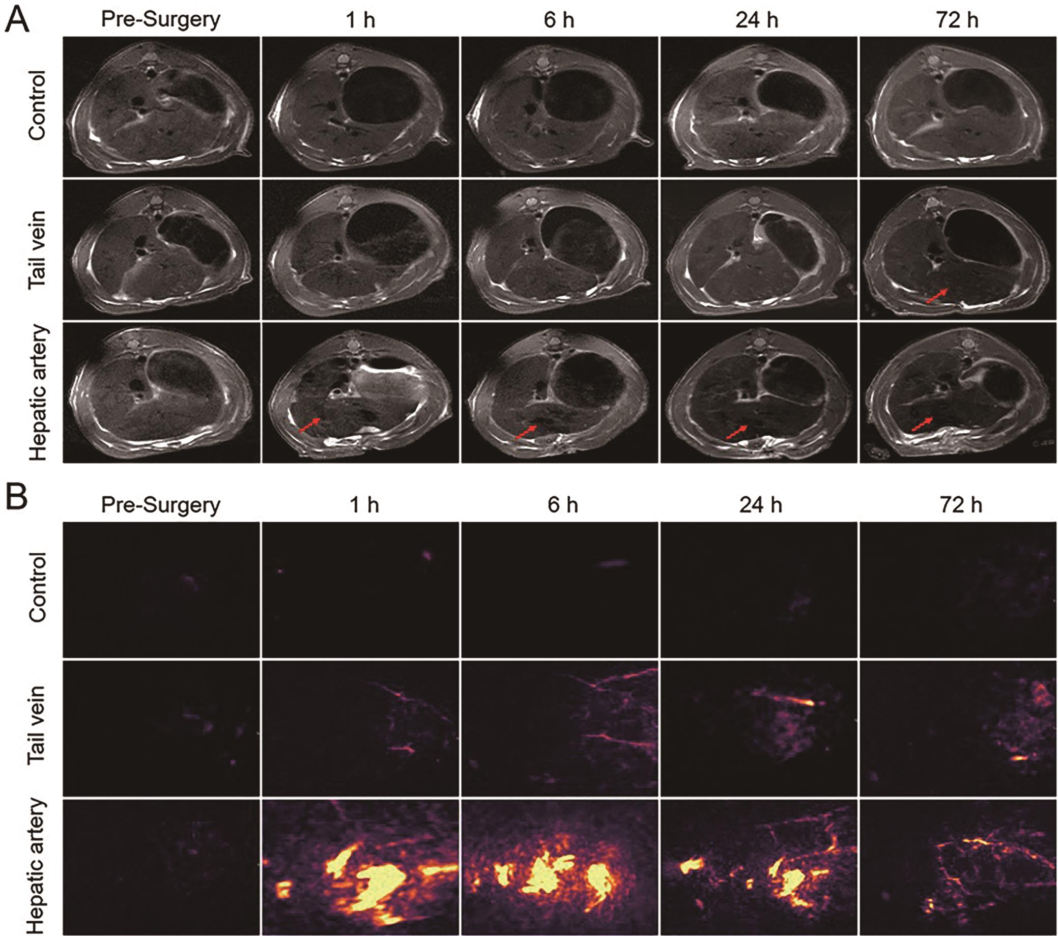 MRI/PAI dual-modal imaging of the rat liver.