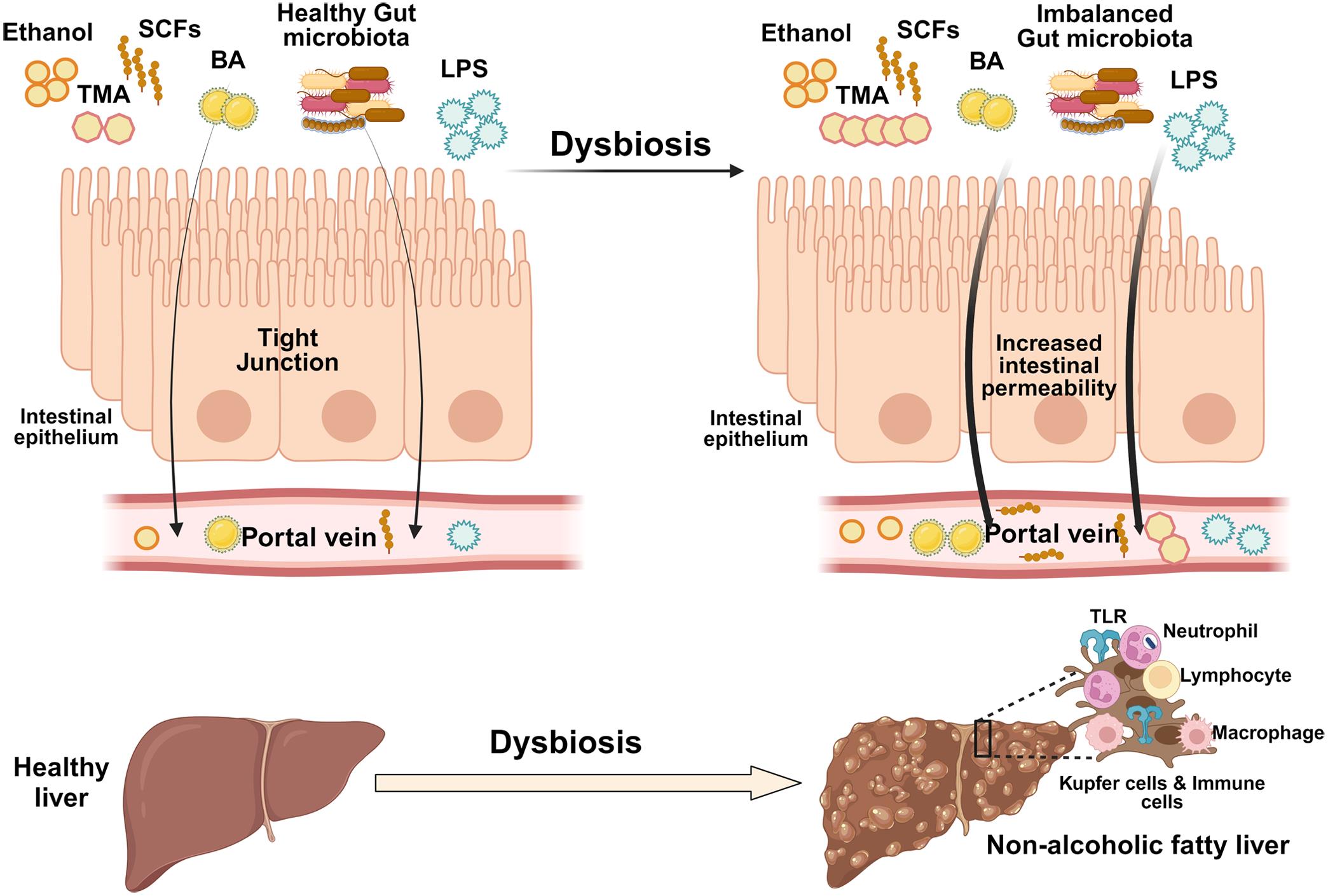 Schematic representation of how the gut microbiota contributes to the development of NAFLD.