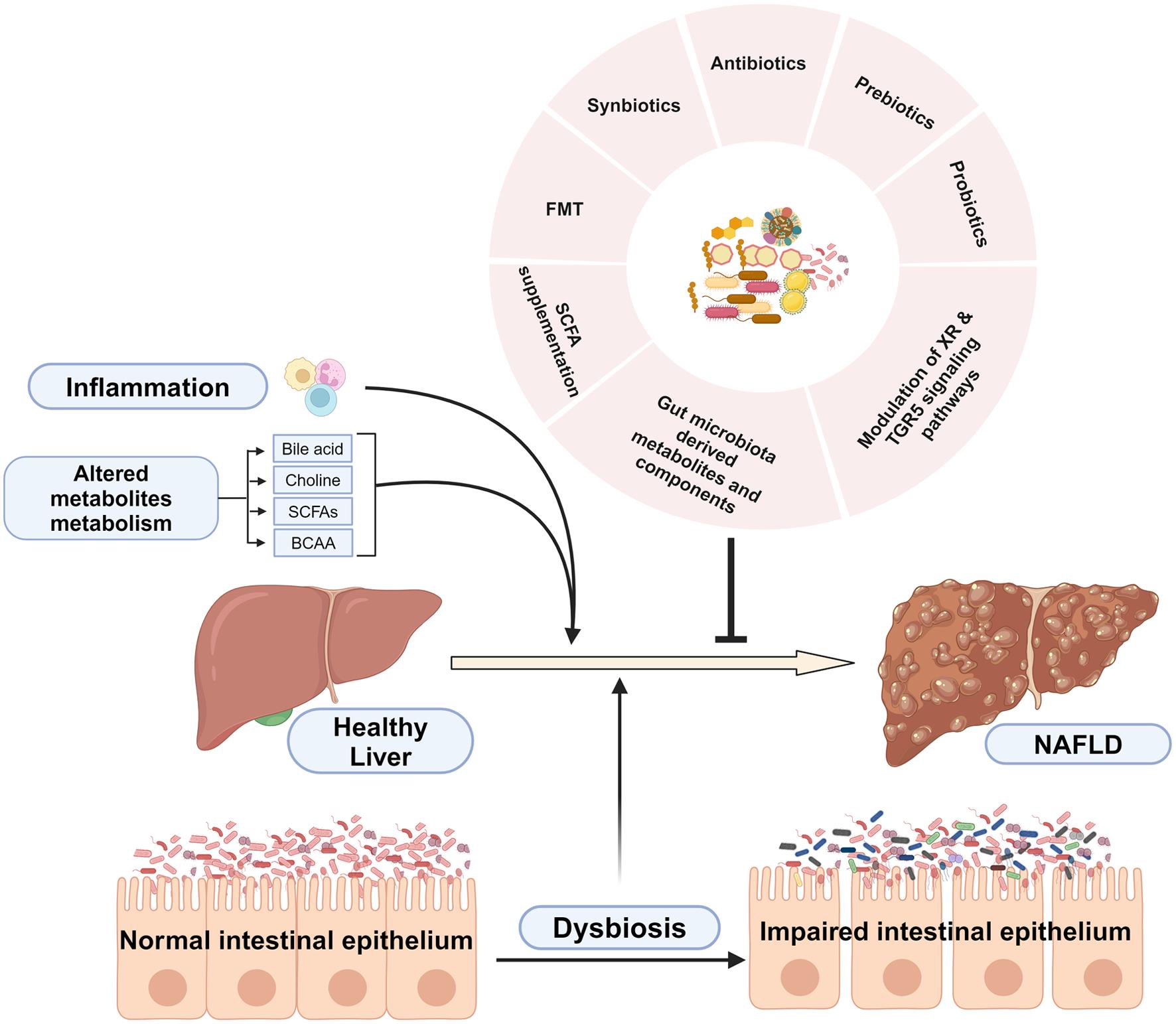 Gut microbiome-centered therapeutic strategies against NAFLD.