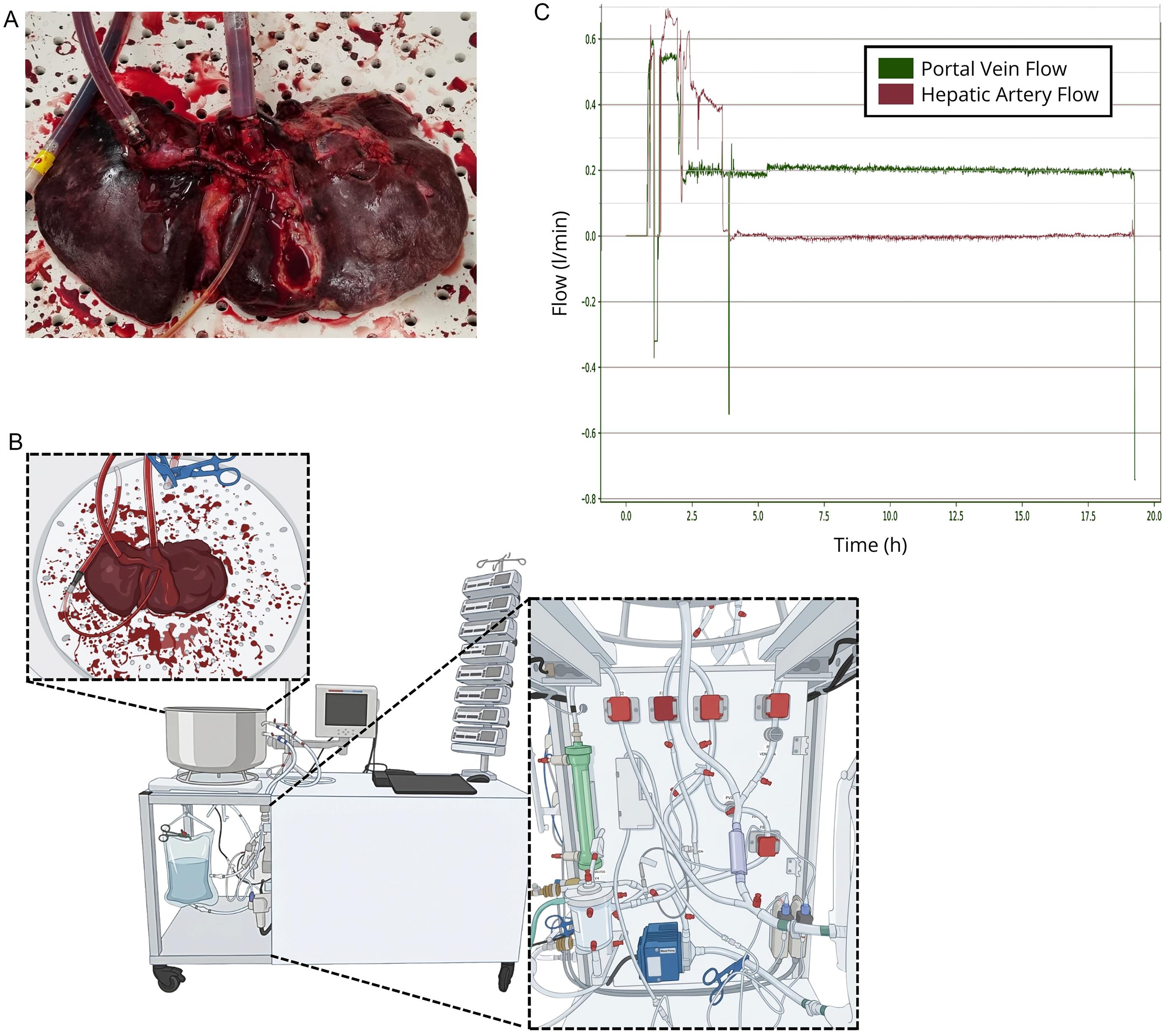 Normothermic machine perfusion of the explanted liver.