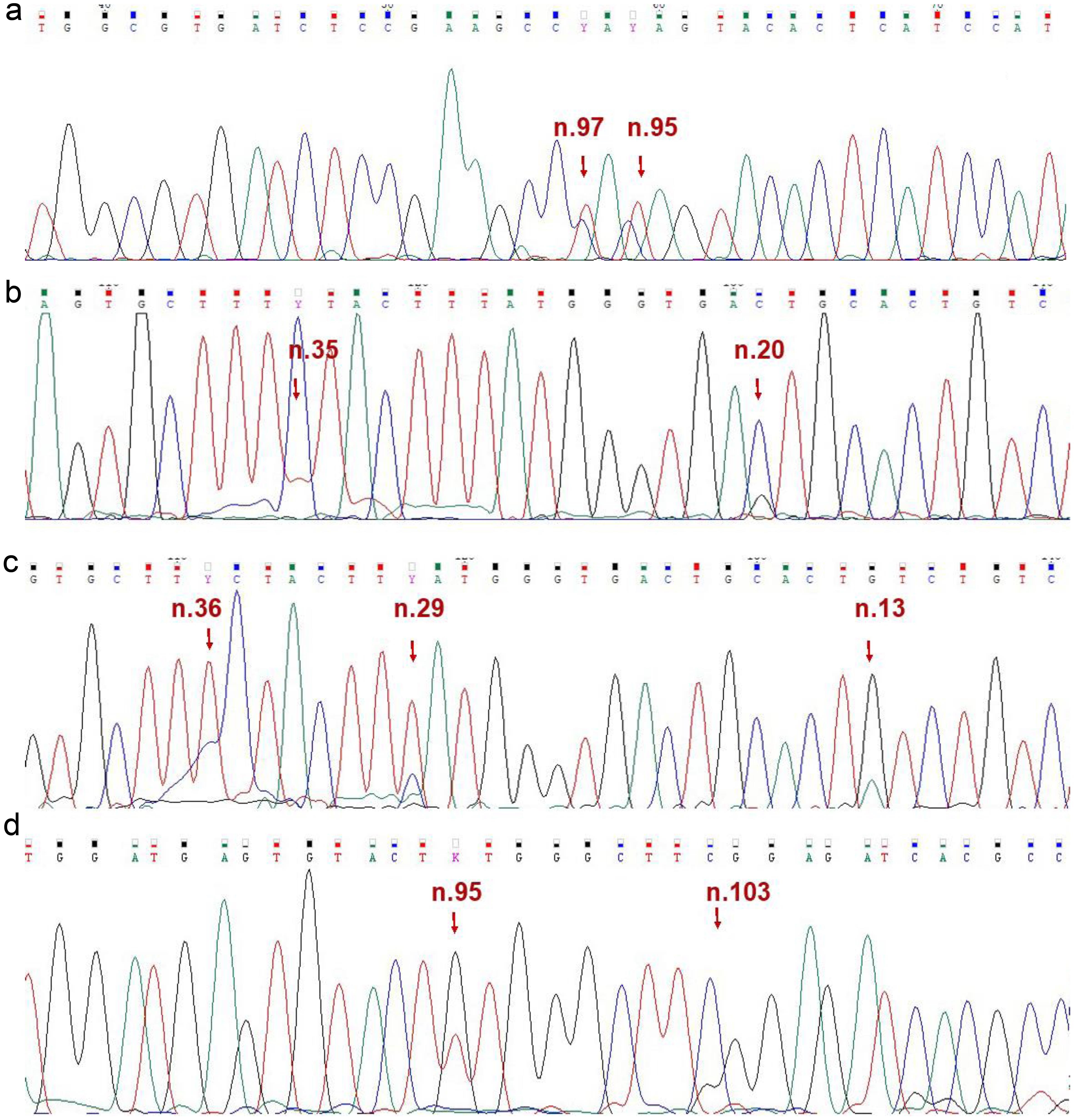 Fragments of the sequence chromatogram obtained using a reverse primer of DNA samples containing mutations n.95G/A and n.97G/A (a); n.20G/C and n.35G/A (b); n.13C/T, n.29A/G and n.36A/G (c); and fragment of the sequence chromatogram obtained using a forward primer of a DNA sample containing mutations n.95G/T and n.113C/G (d) in the <italic>MIR142</italic> gene.