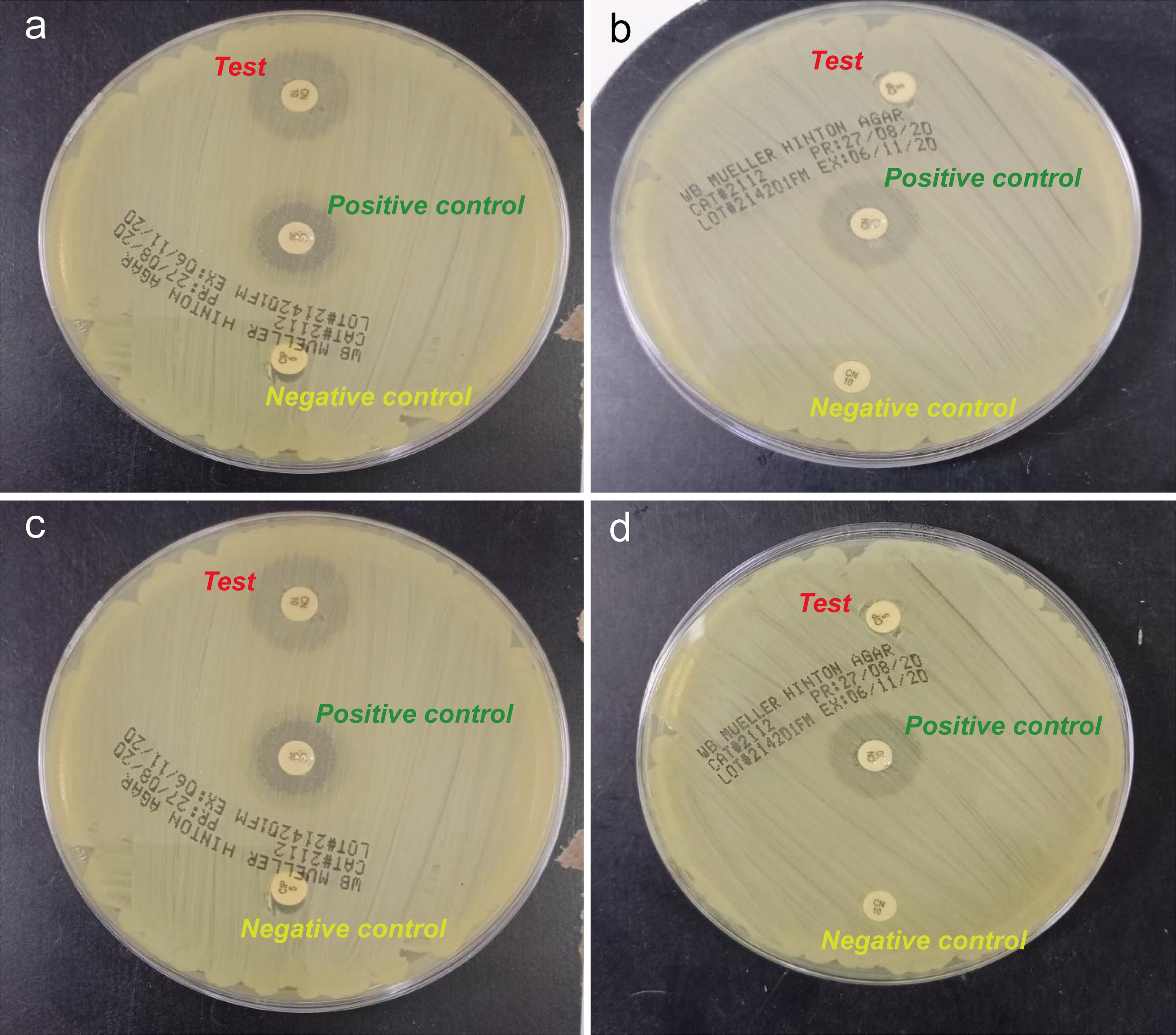 Zones of inhibition at 48 h post-incubation with the clove essential oil (CEO) and miswak extract mixture for all four microorganisms. (a) Zones of inhibition at 48 h post-incubation with clove essential oil and miswak extract mixture for <italic>Fusobacterium nucleatum</italic>. (b) Zones of inhibition at 48 h post-incubation with clove essential oil and miswak extract mixture for <italic>Aggregatibacter actinomycetemcomitans</italic>. (c) Zones of inhibition at 48 h post-incubation with clove essential oil and miswak extract mixture for <italic>Porphyromonas gingivalis</italic>. (d) Zones of inhibition at 48 h post-incubation with clove essential oil and miswak extract mixture for <italic>Prevotella intermedia</italic>.