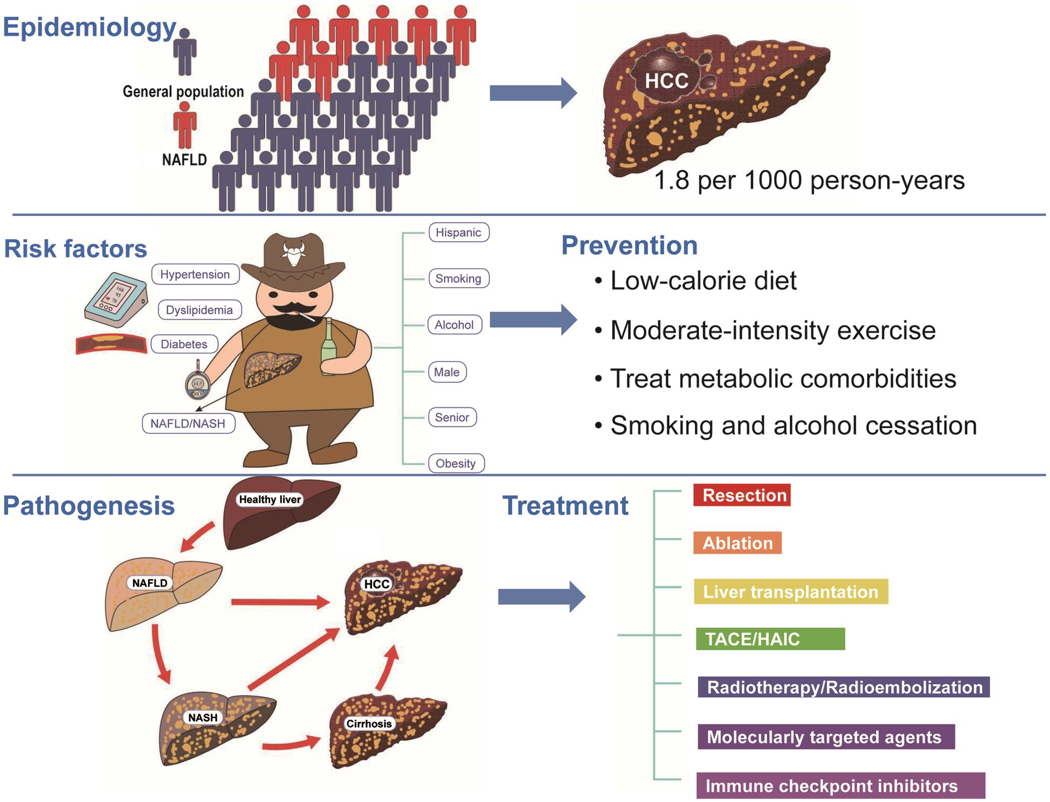 Epidemiology, risk factors, prevention, pathogenic pathways, and treatment strategies of non-alcoholic fatty liver disease-related HCC.