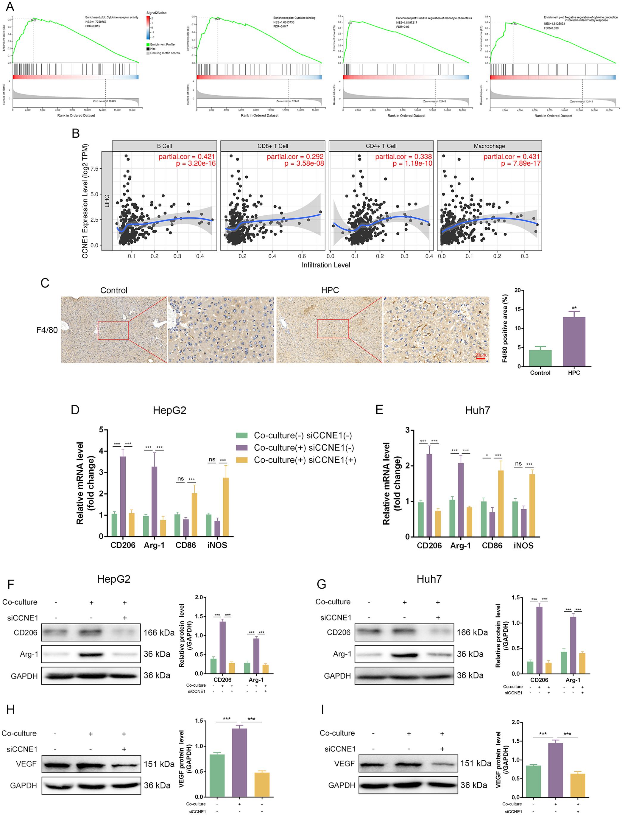 Effect of CCNE1 on macrophage polarization.