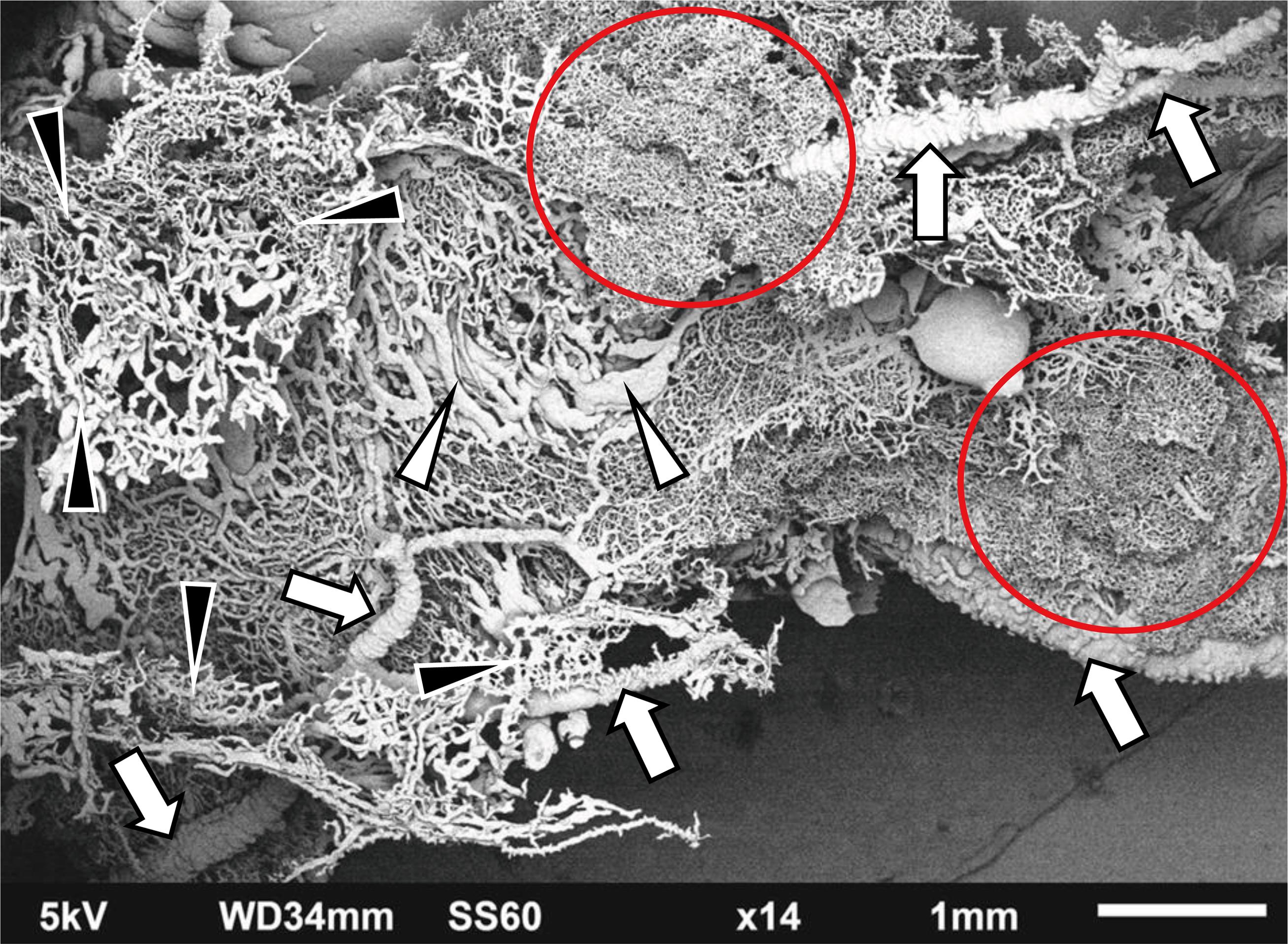 Scanning electron microscopy of corrosion casts of the biliary pathway of rats at 2 weeks after CBDO.