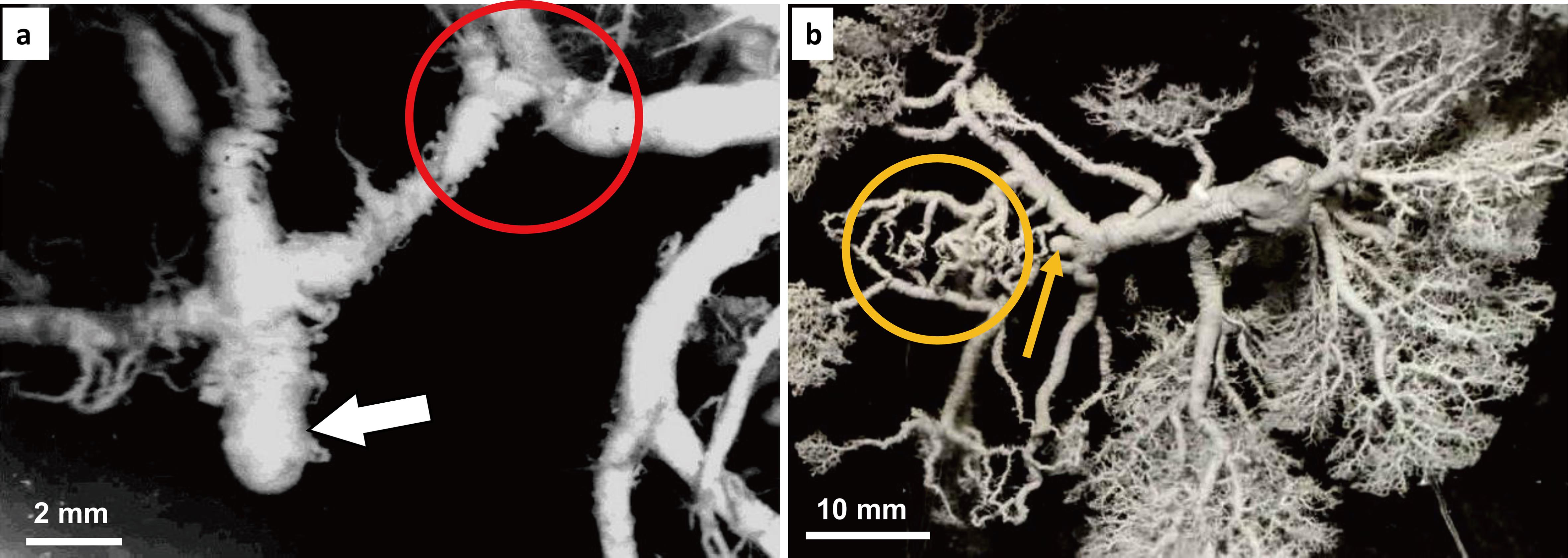 Corrosion casts of biliary (a) and portal vein (b) branches in dogs.