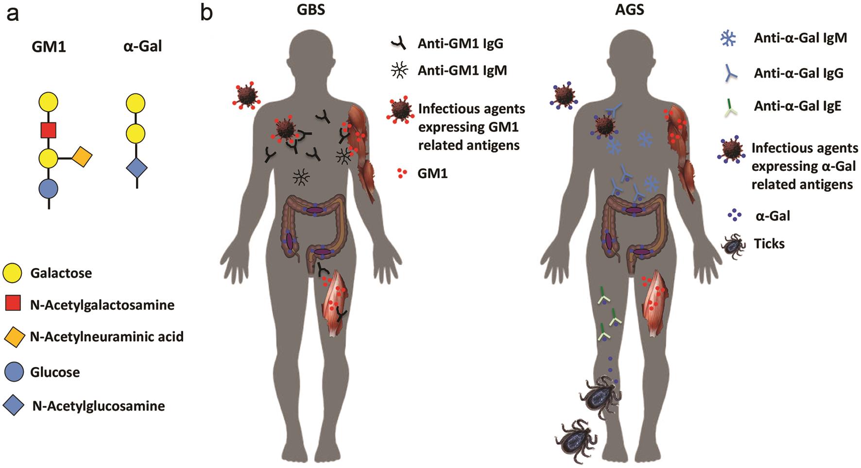 Immunological similarities between GBS and AGS.