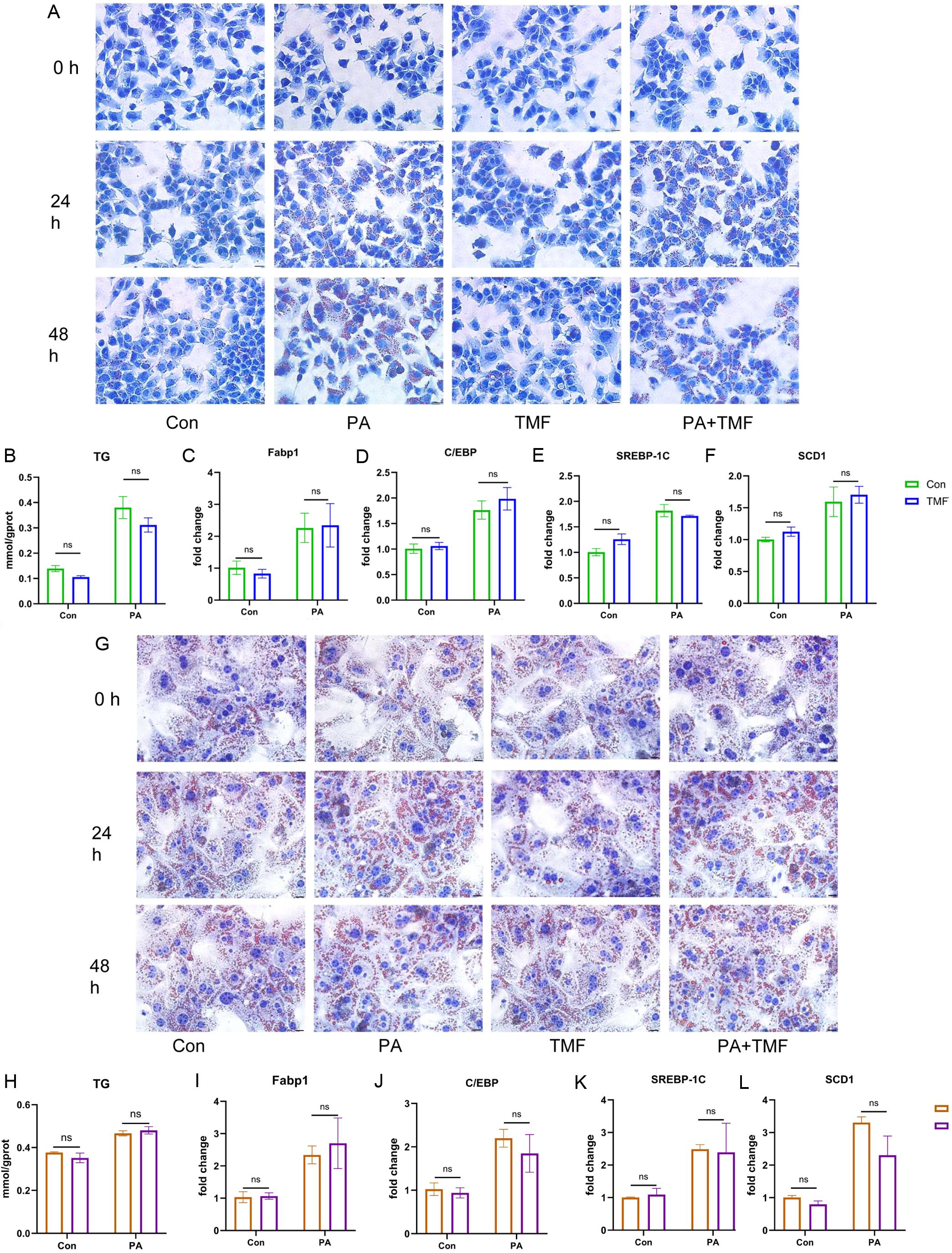 Effect of TMF on lipid accumulation and lipogenic gene expression in AML12 cell lines and primary hepatocytes <italic>in vitro</italic>.