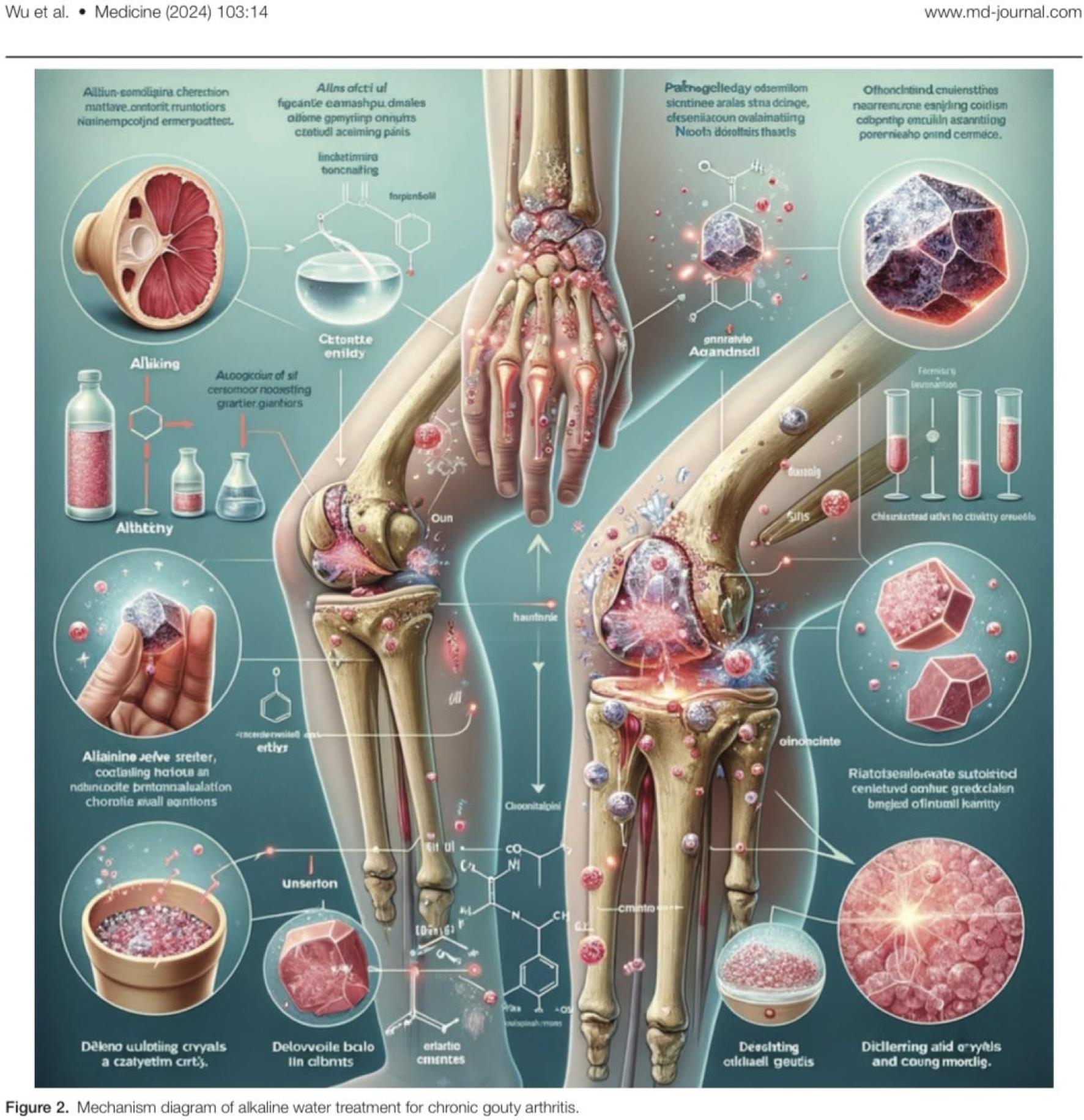 发表在<italic>Medicine</italic>上的被撤稿论文图中小腿和手臂的骨骼数量有误，并且有一些无意义的标注，如“chlsinkestead atlvs no ctivktty greuedis”和“Aliainine jerve sreiter”（图片来自<italic>Medicine</italic> (lww.com)）。