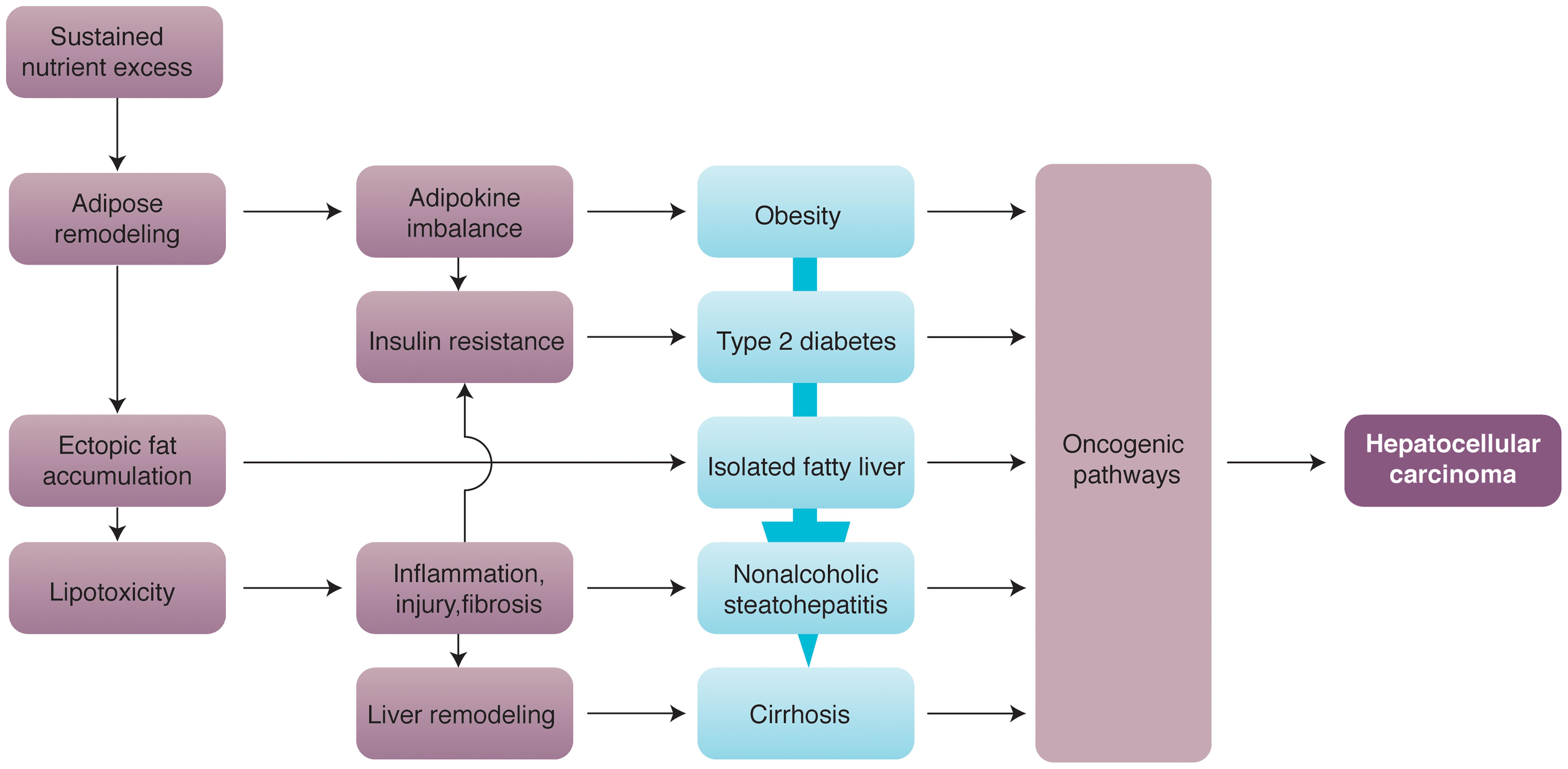 Major mechanisms of hepatocarcinogenesis in NAFLD