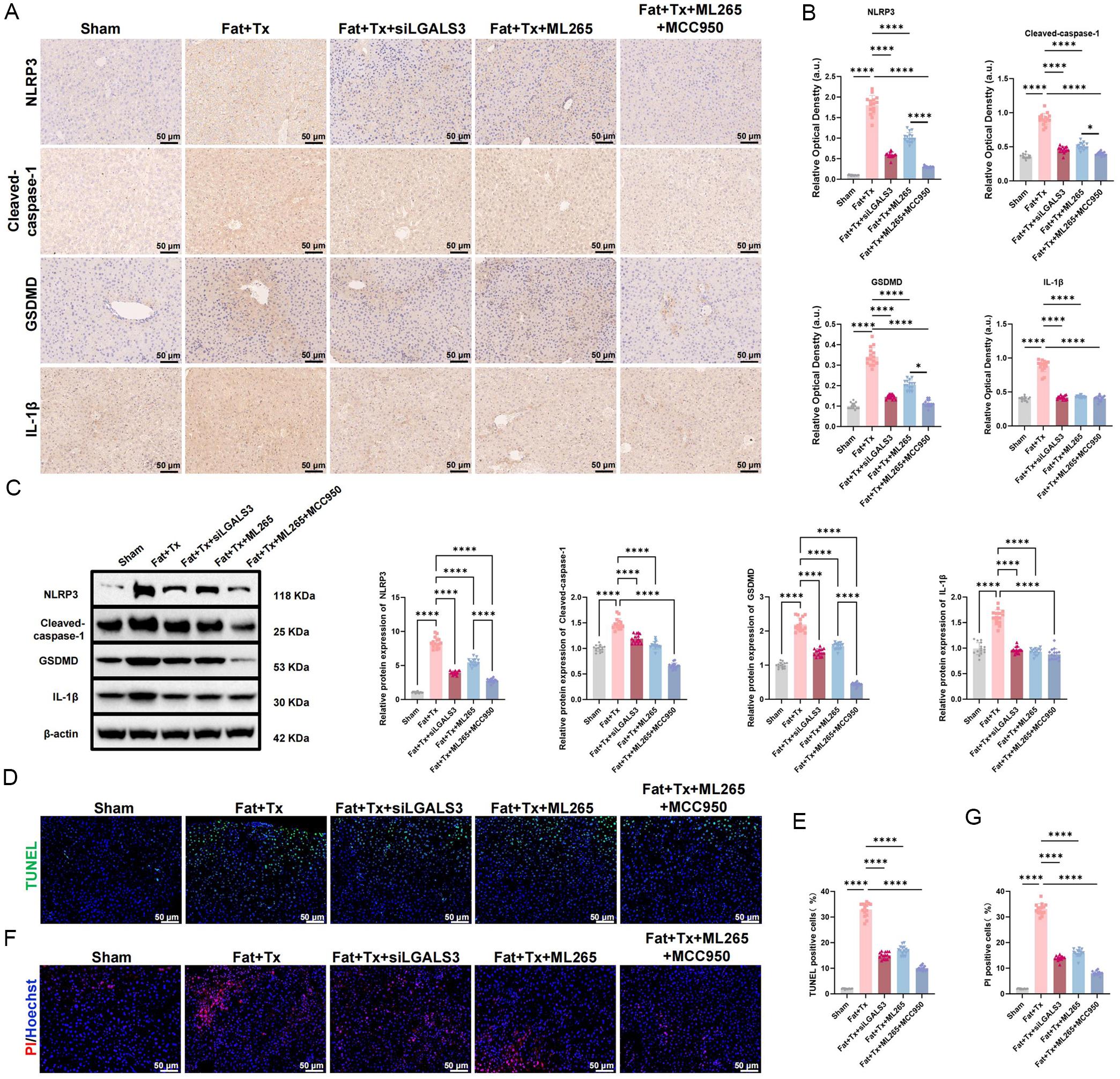 Assessment of pyroptosis-associated markers and cell death in liver grafts after transplantation.