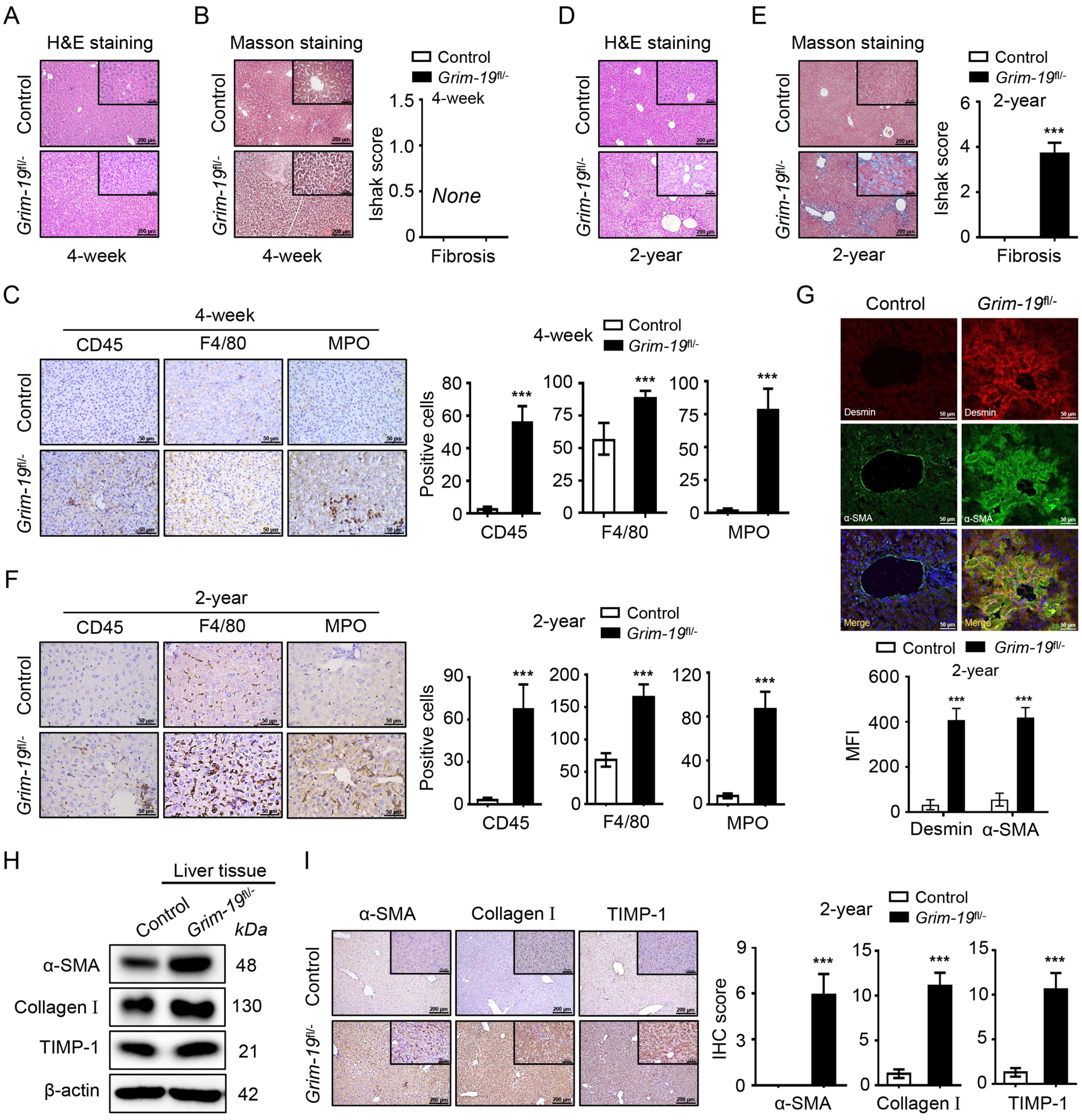 Hepatocyte-specific <italic>GRIM19</italic> (gene associated with retinoid-IFN-induced mortality 19) deletion triggers spontaneous chronic liver fibrogenesis in mice.