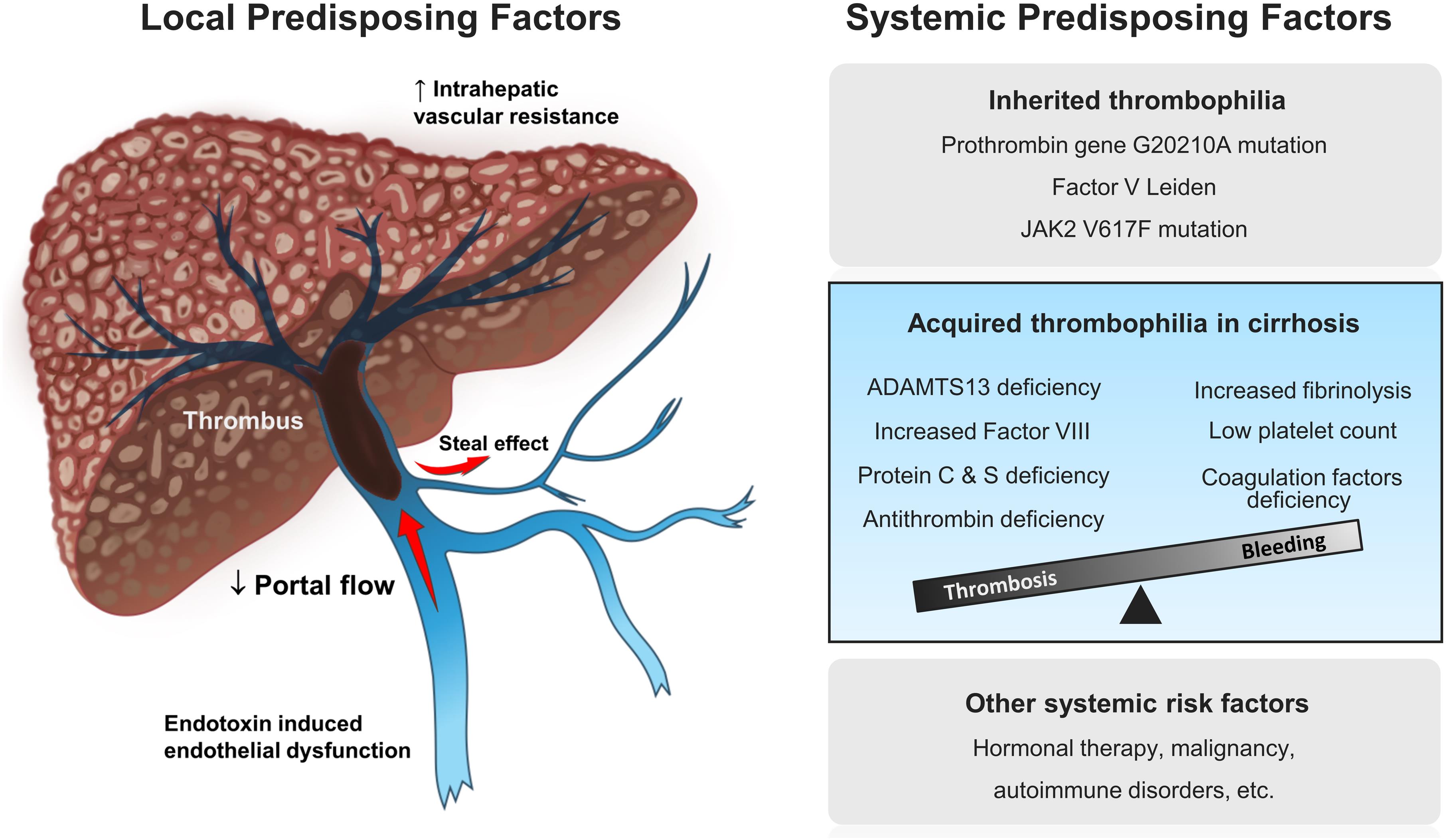 Nontumoral Portal Vein Thrombosis A Challenging Consequence Of Liver 