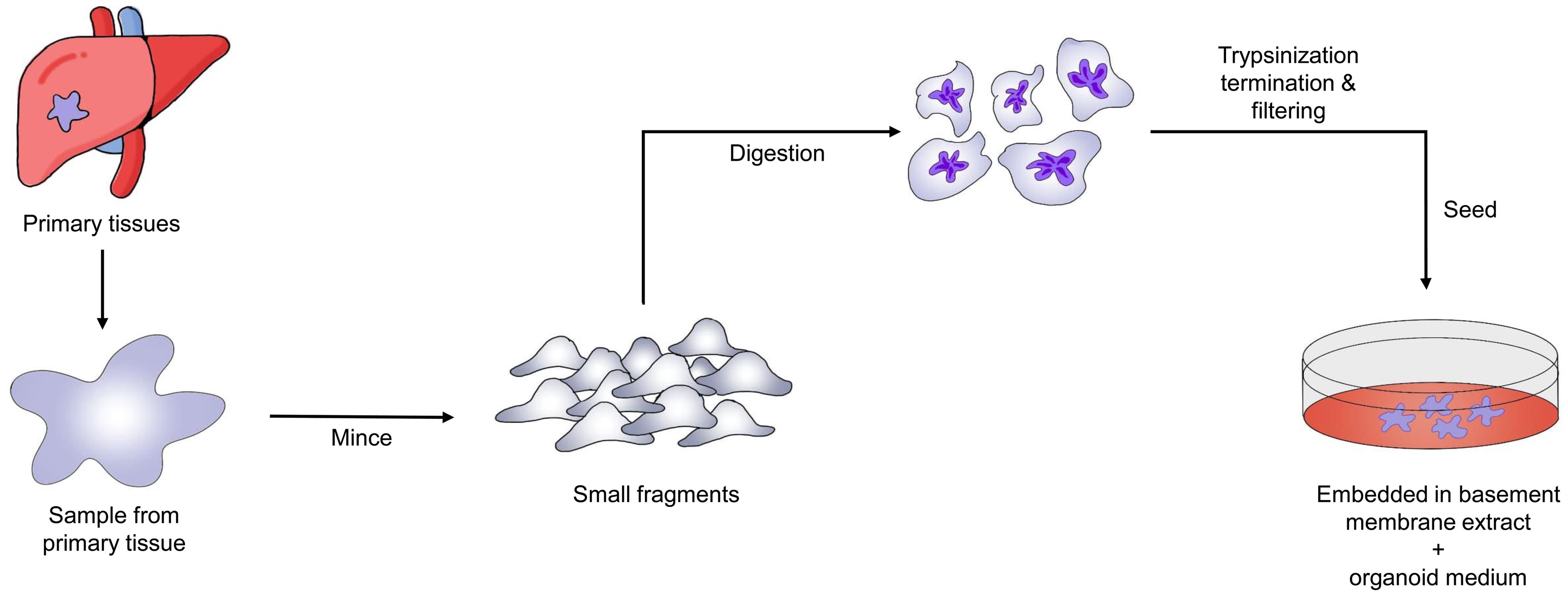 Flow chart for Patient-derived Tumor Organoids (PDTO) establishment process from liver cancer.