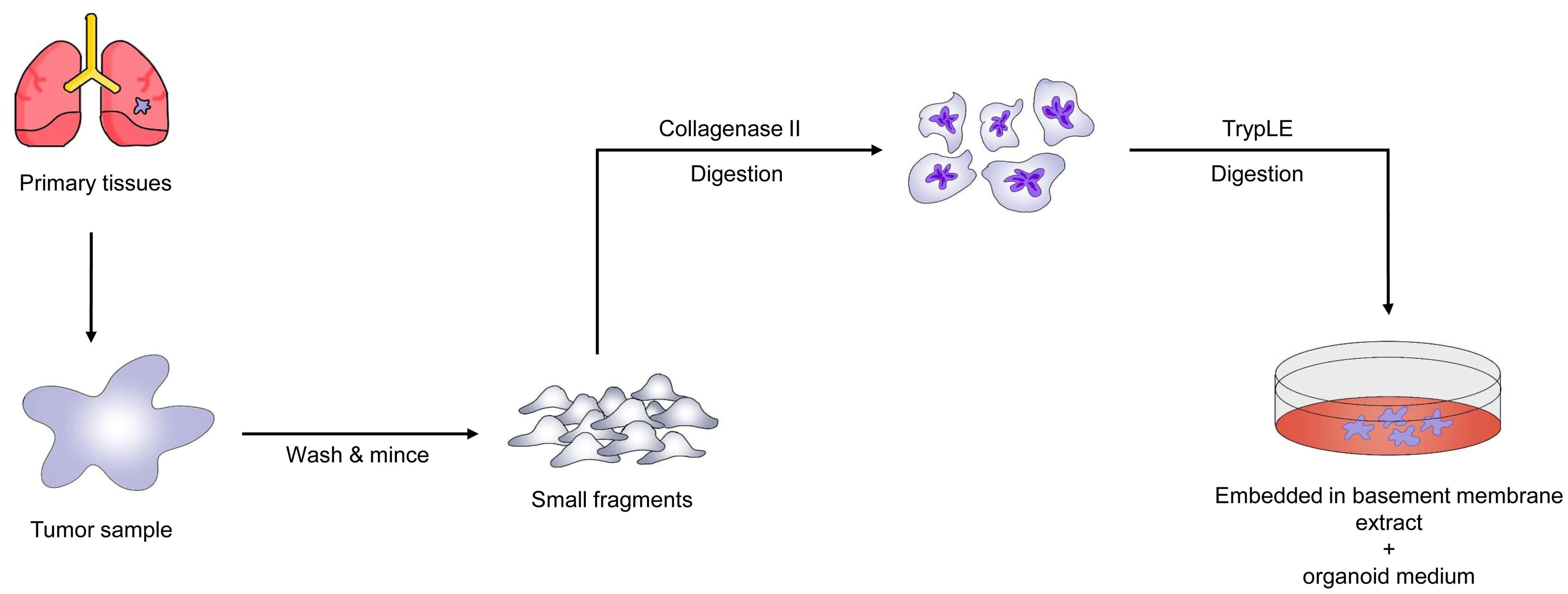 Flow chart for Patient-derived Tumor Organoids (PDTO) establishment process from lung cancer.