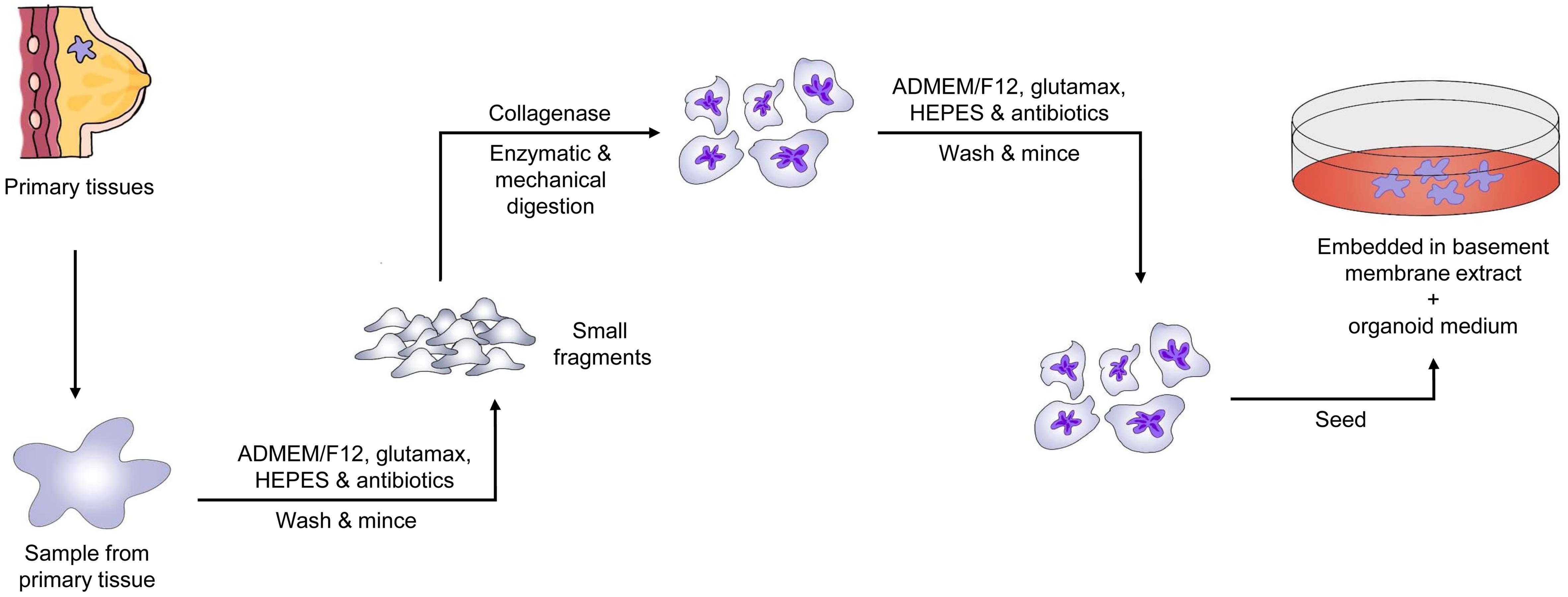 Flow chart for Patient-derived Tumor Organoids (PDTO) establishment process from breast cancer.