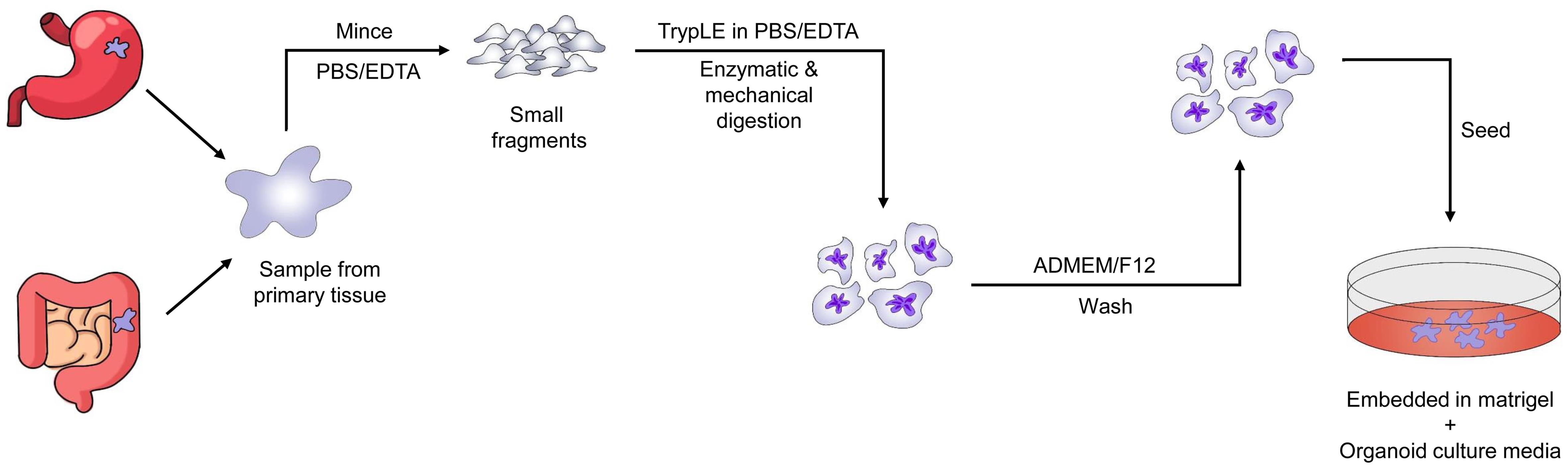 Flow chart for Patient-derived Tumor Organoids (PDTO) establishment process from gastro-intestinal cancer.
