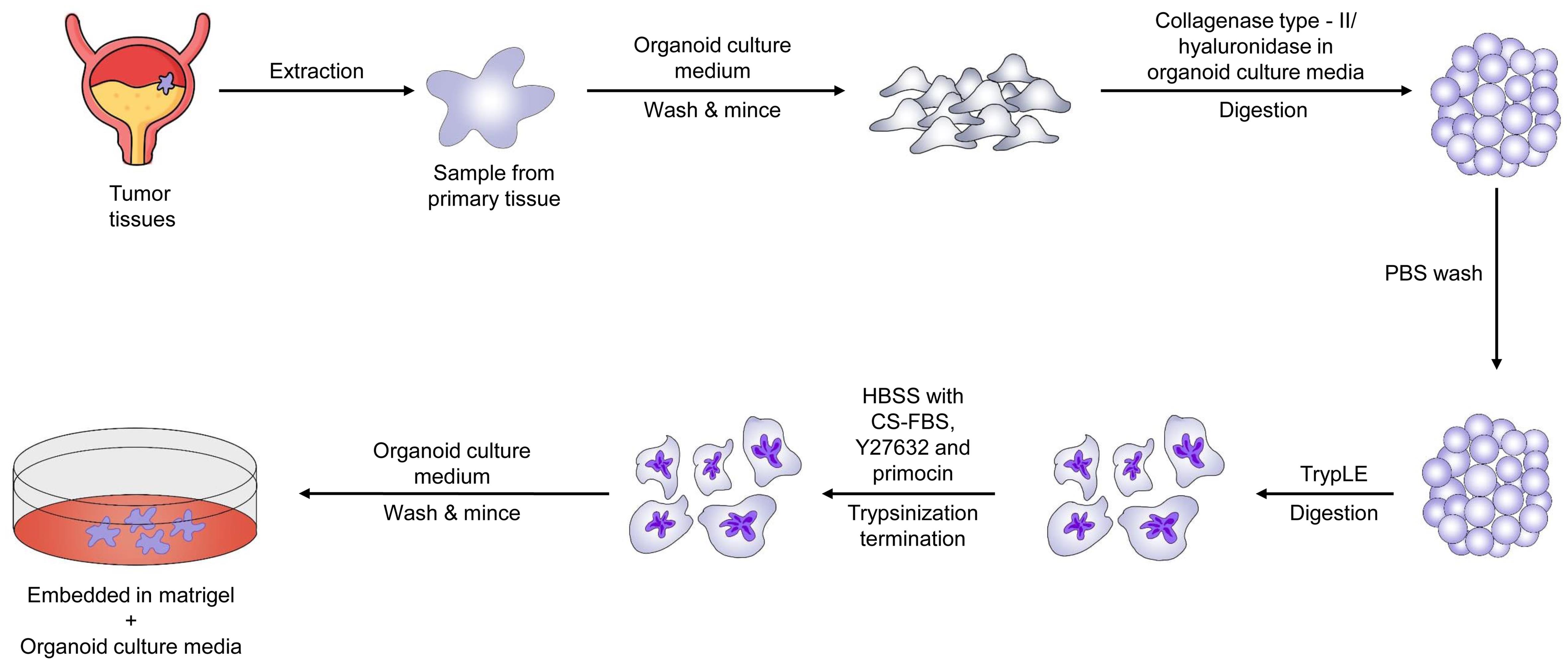 Flow chart for Patient-derived Tumor Organoids (PDTO) establishment process from bladder cancer.