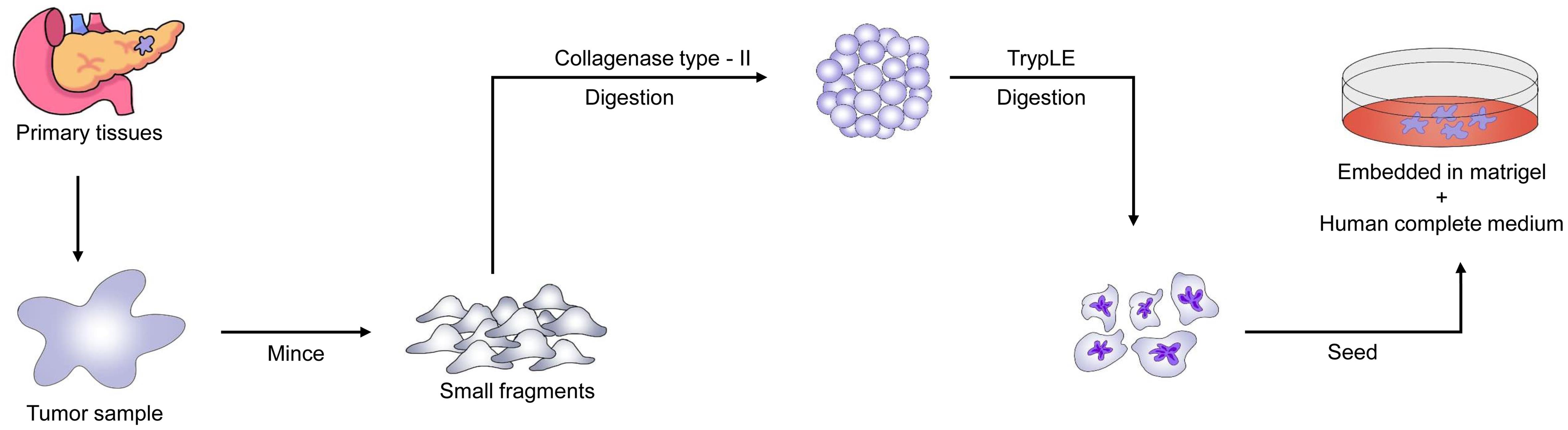 Flow chart for Patient-derived Tumor Organoids (PDTO) establishment process from pancreatic cancer.