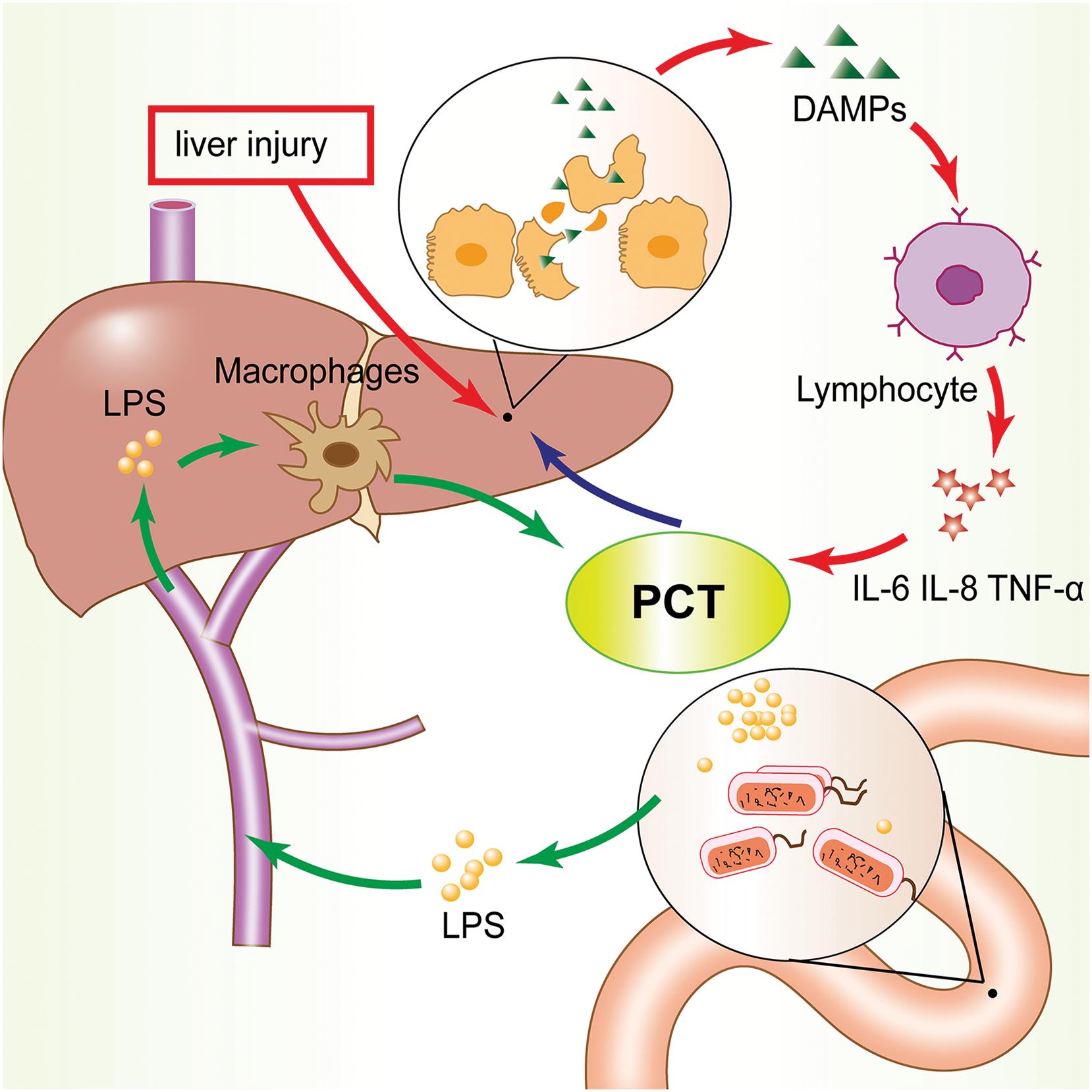 Possible pathophysiological mechanisms of the relationship between PCT and liver damage.