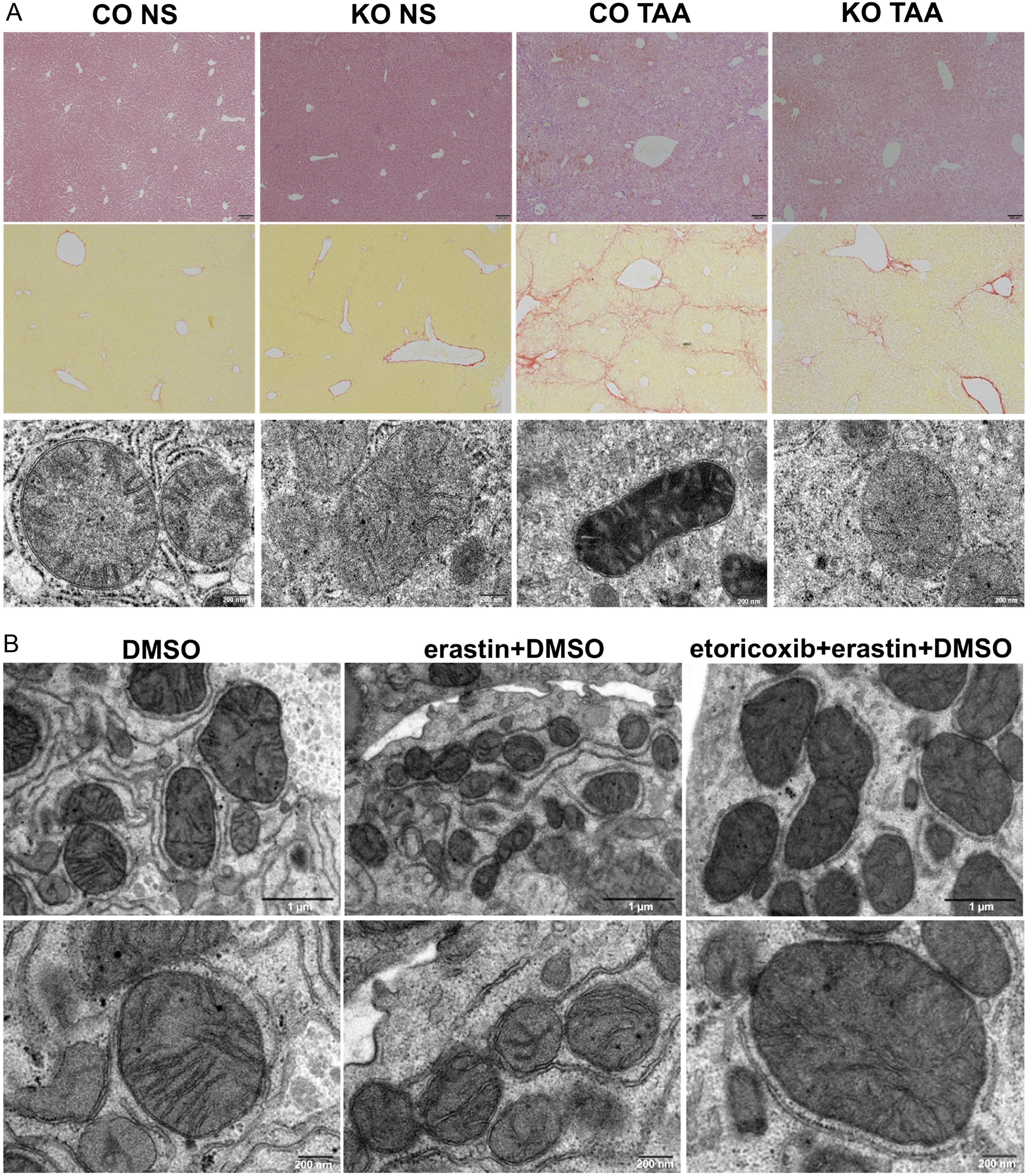 Microscopic changes in mouse livers and primary mouse hepatocytes.