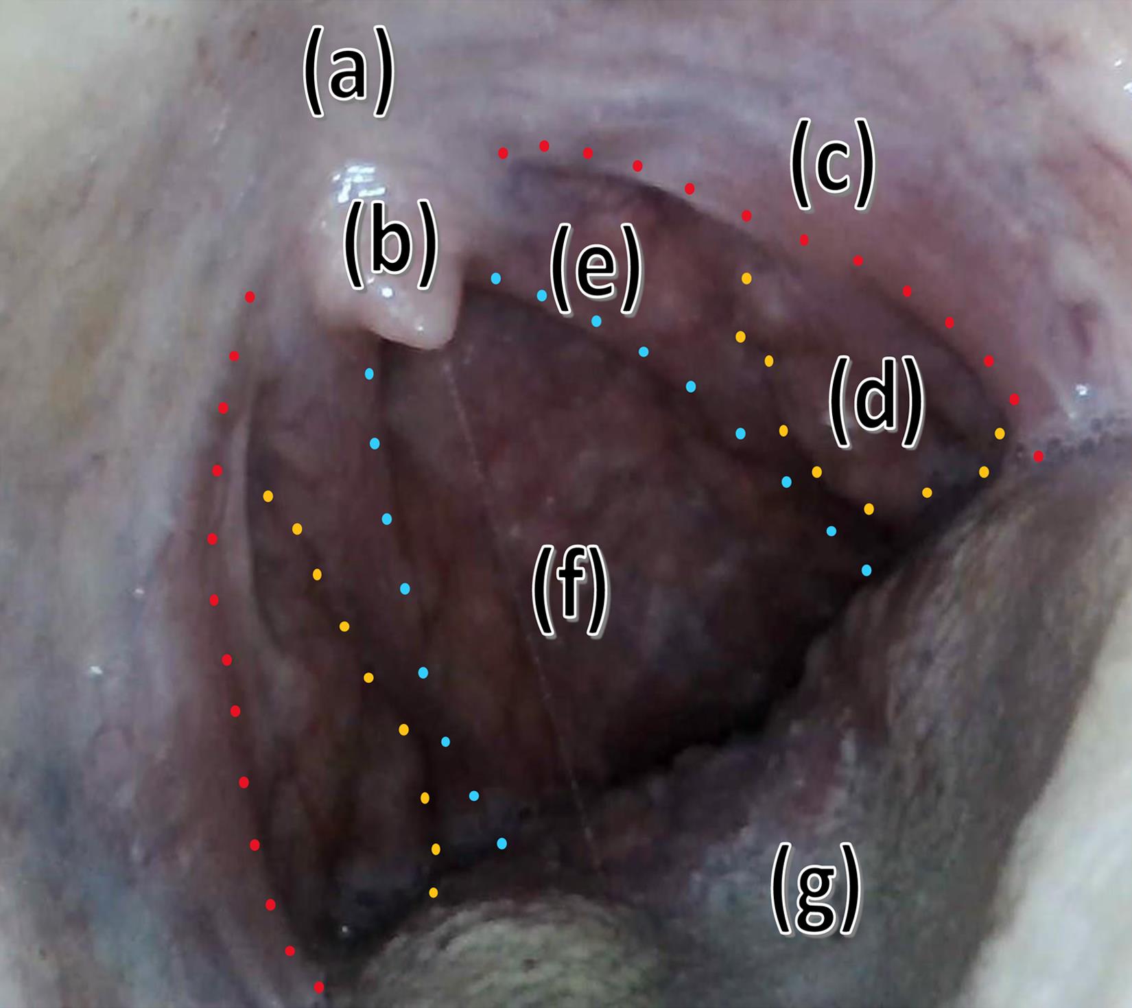 Still image from a video of the oropharynx.