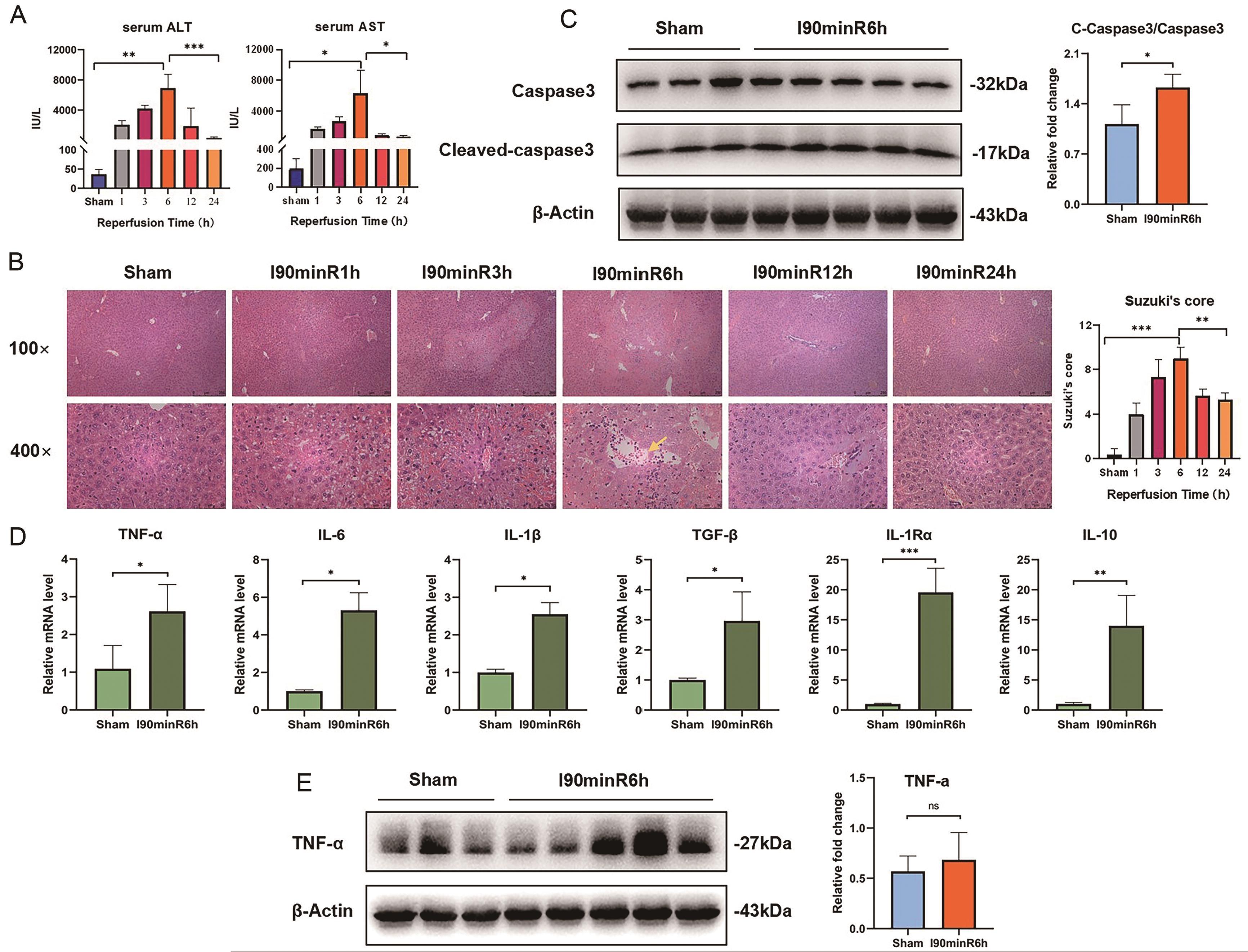 Expression of apoptosis and inflammatory factors increased in mice liver after IR-stress.