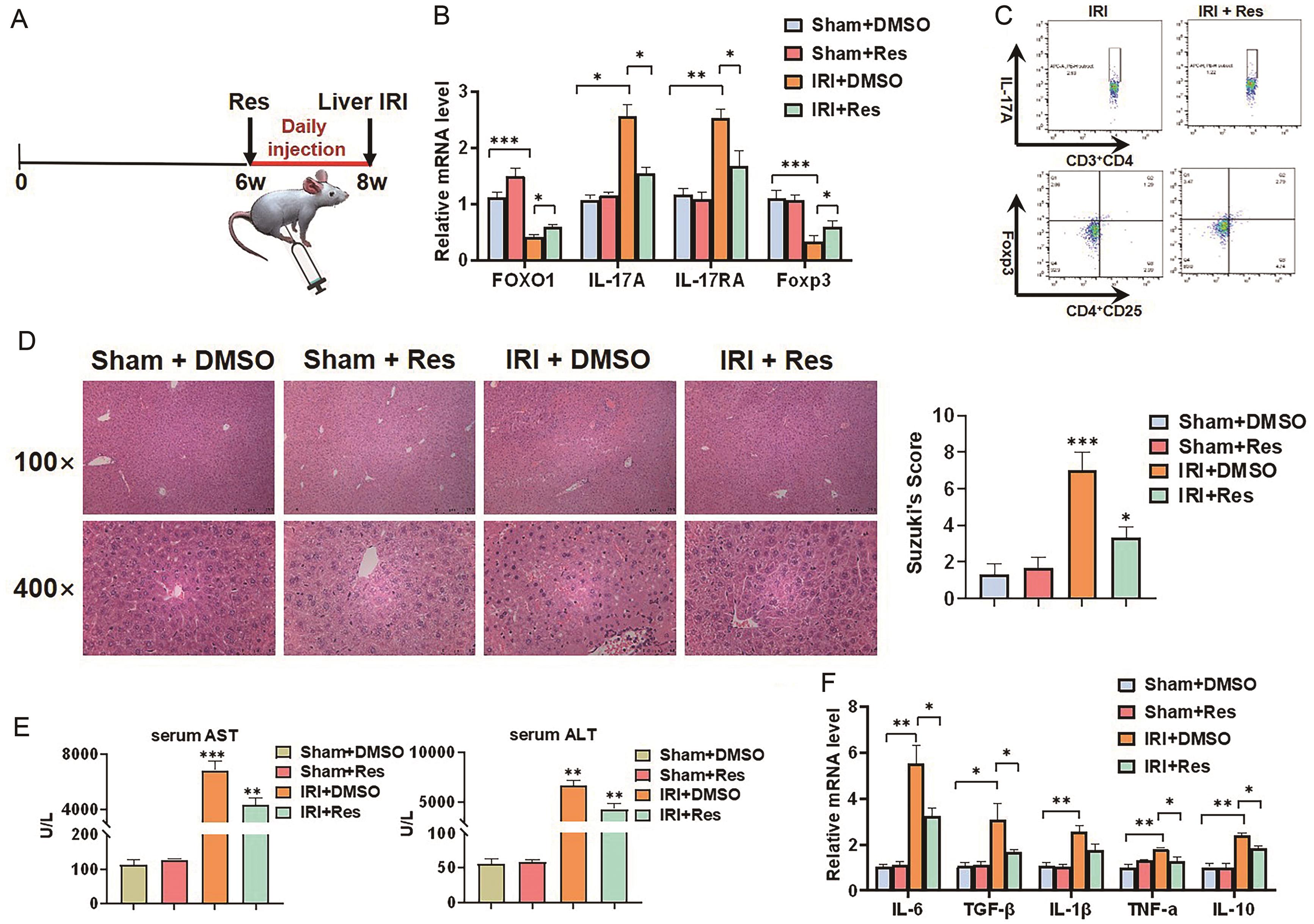 Up-regulation of FOXO1 reverses Th17/Treg cytokine imbalance to alleviate liver IRI.