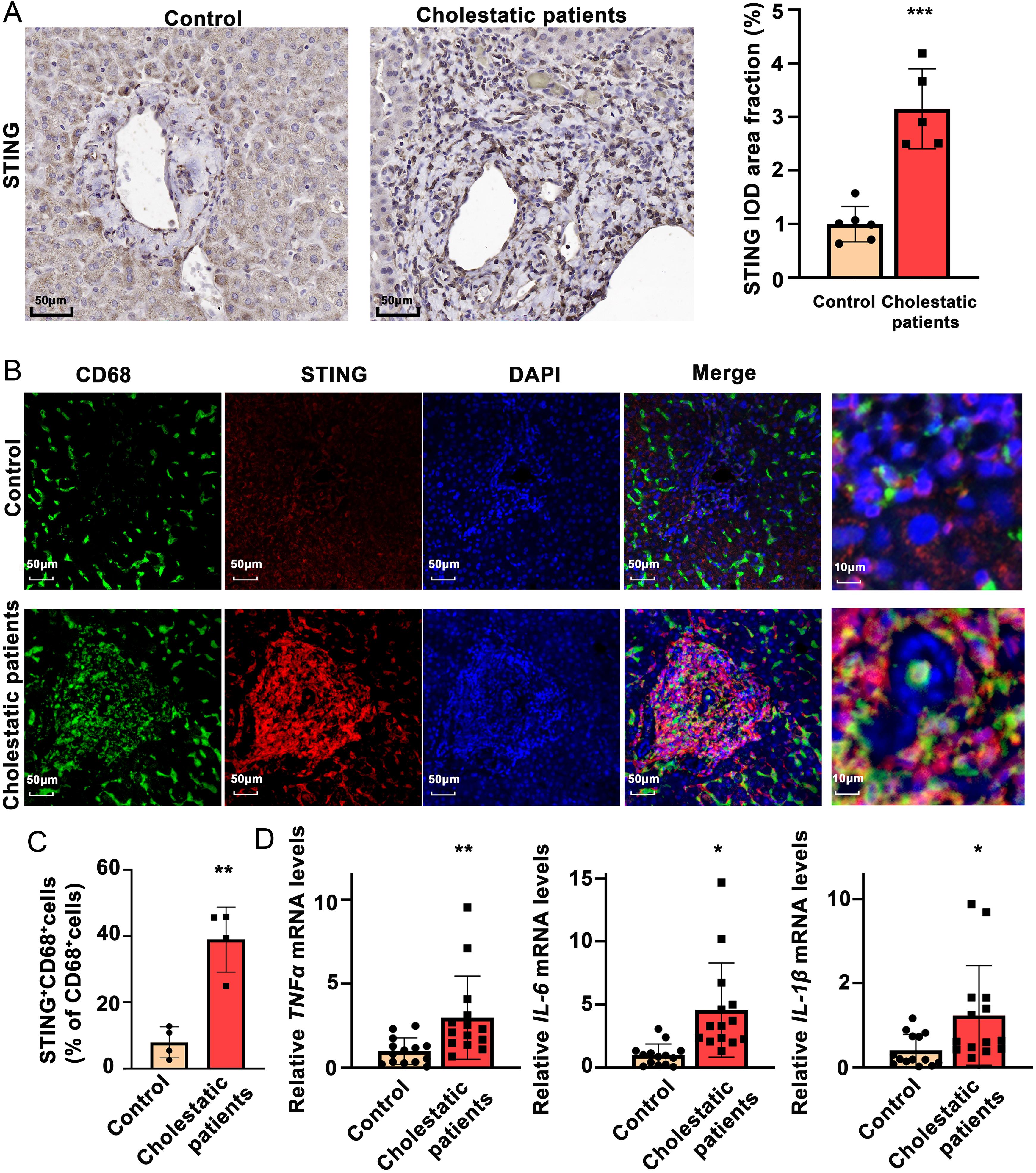 Patients with cholestasis had increased expression of STING.