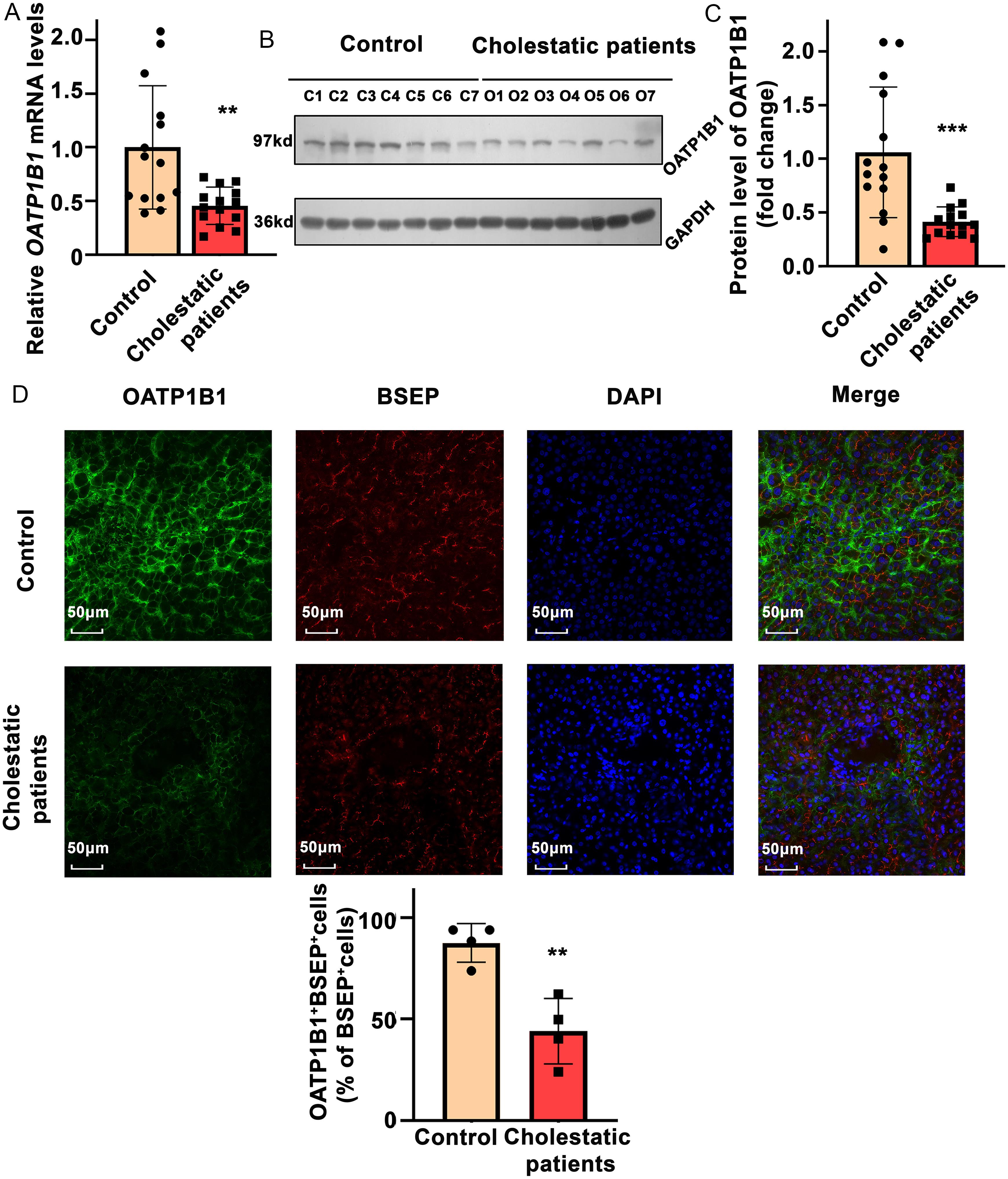 Patients with cholestasis had diminished hepatic expression of OATP1B1.