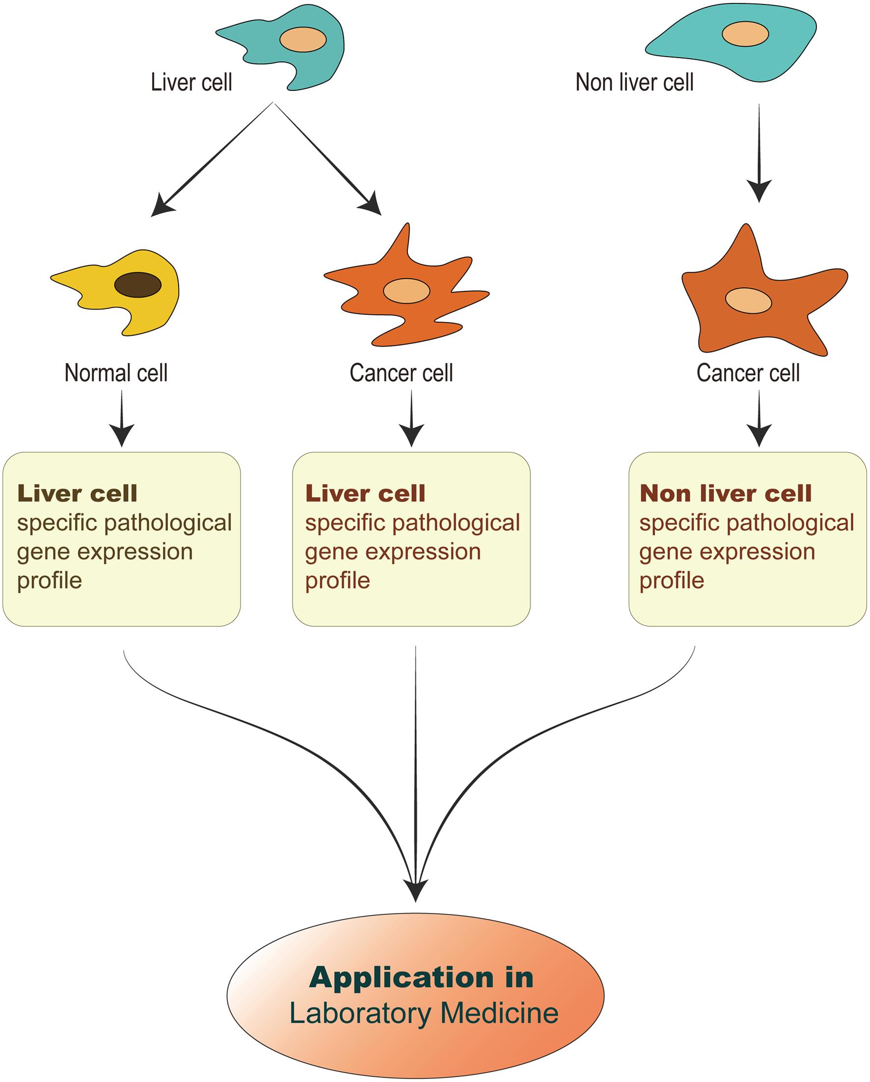 liver cancer research article