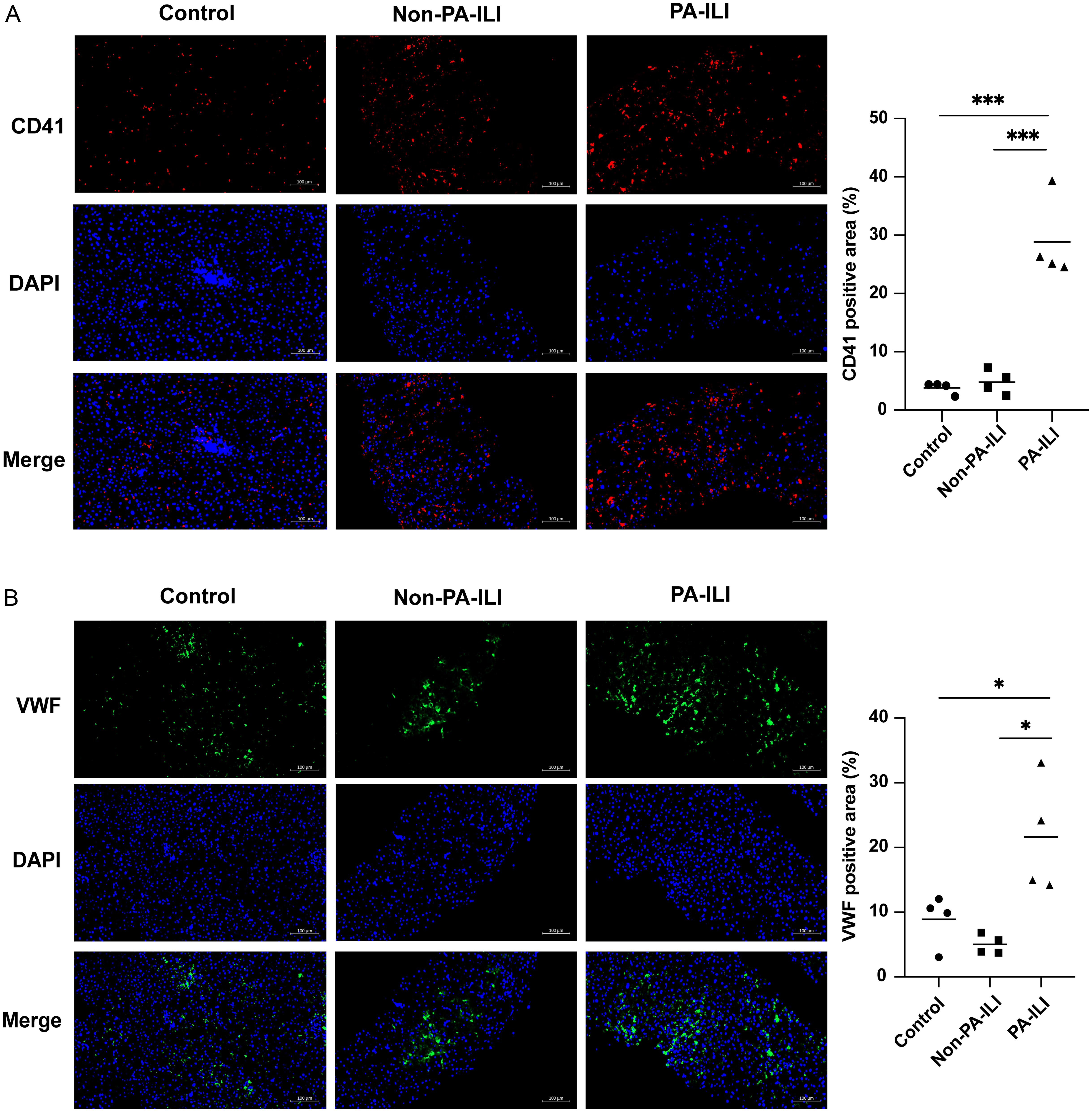 Hepatic platelet accumulation and VWF distribution in PA-ILI patients.