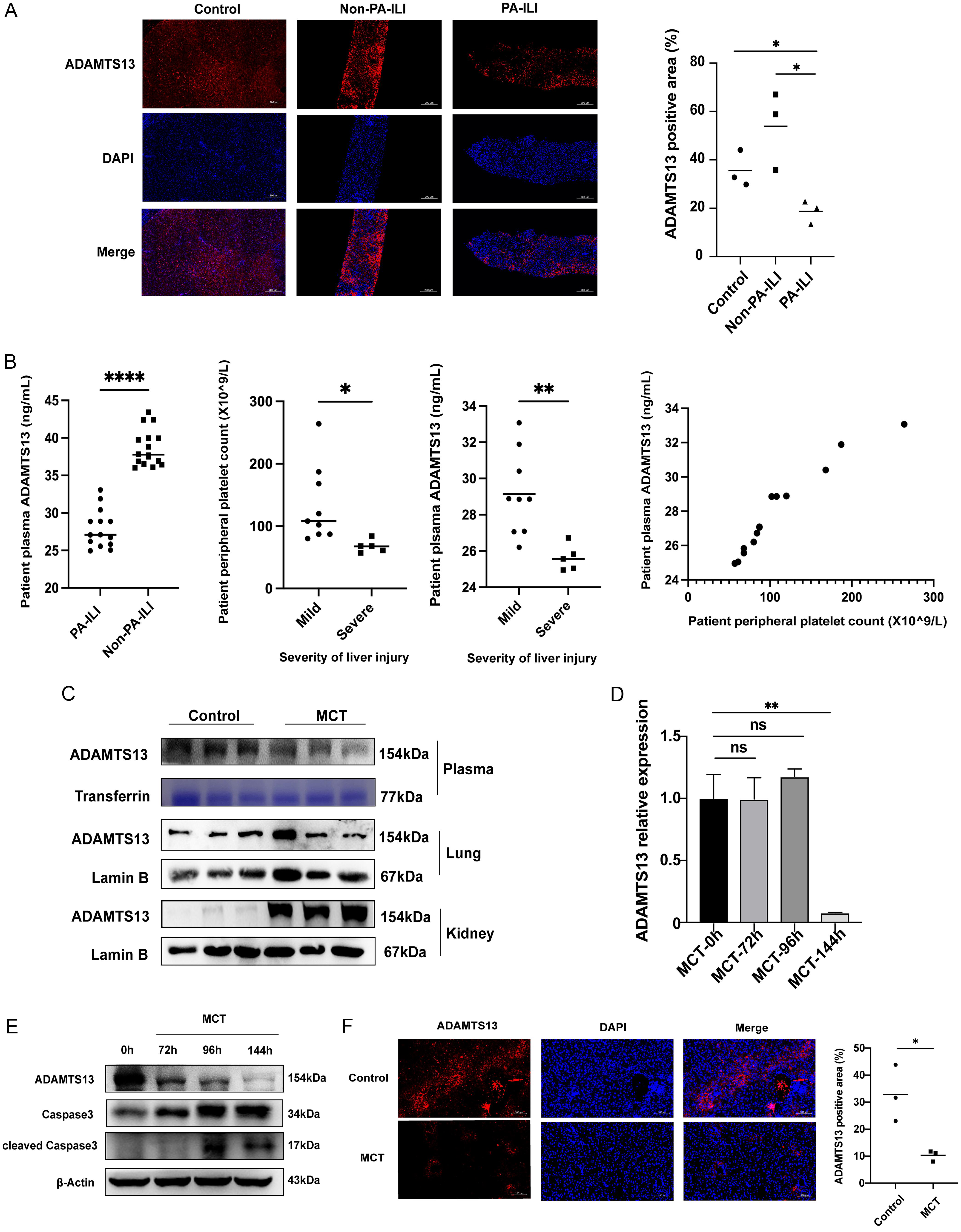 Hepatic ADAMTS13 expression is reduced in PA-ILI.