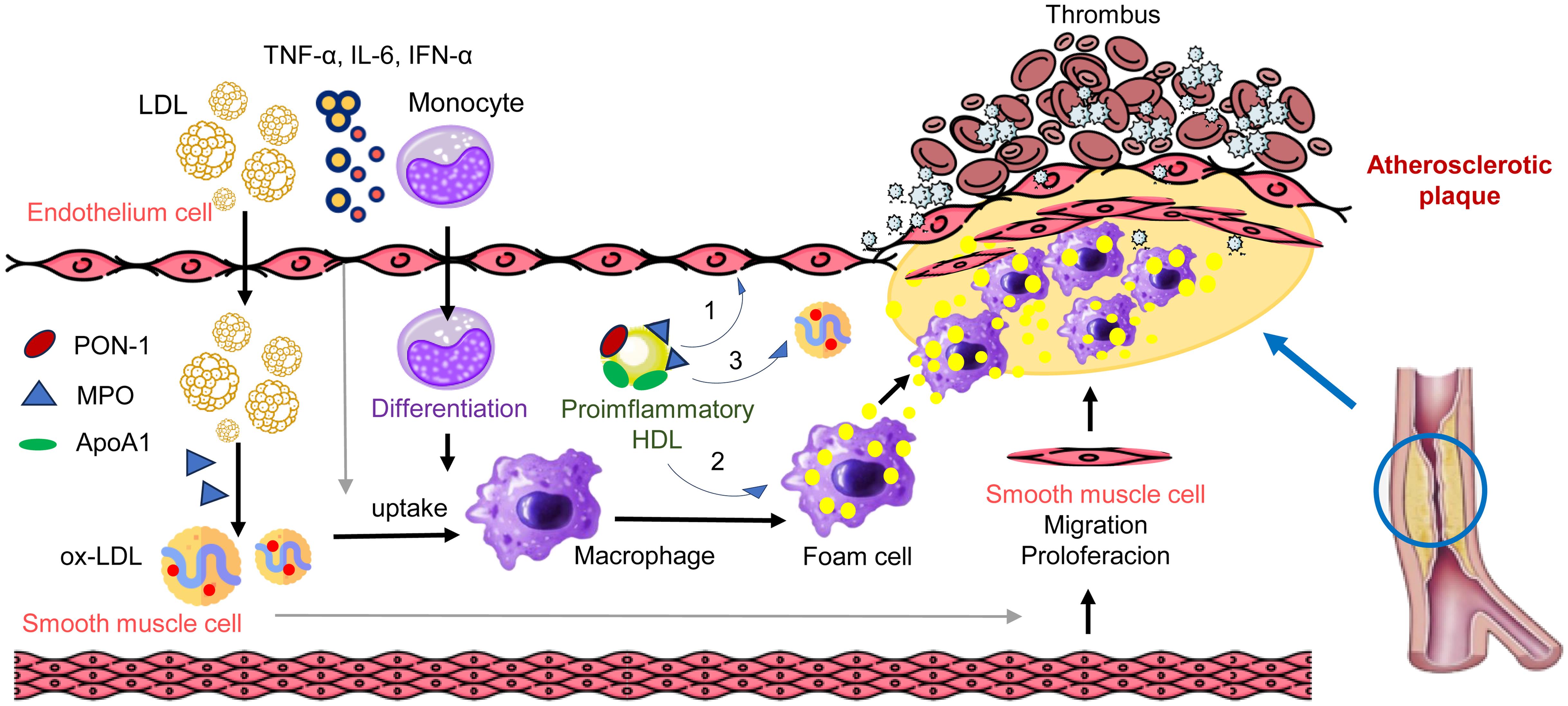 LDL passes through the endothelium.