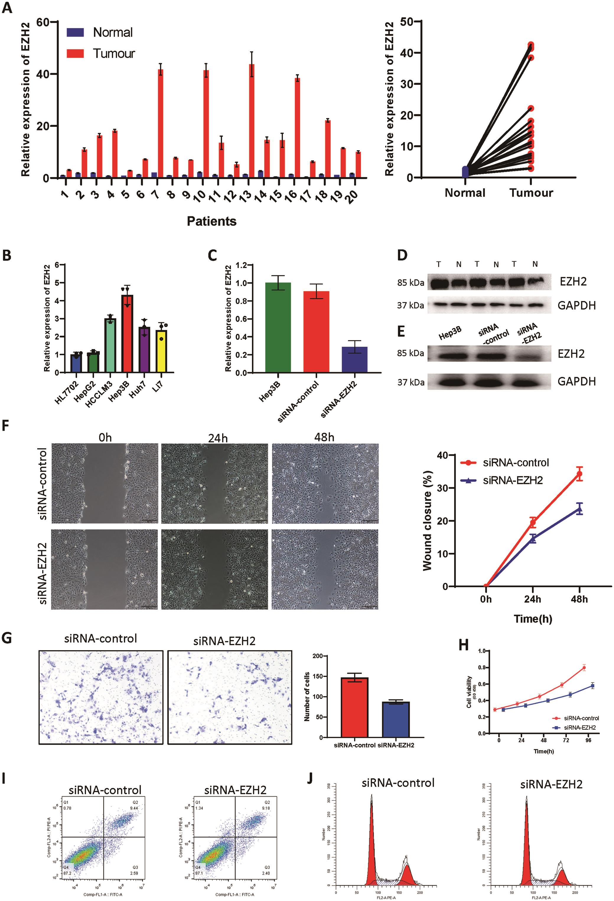Expression of EZH2 and its cancer-promoting effect.