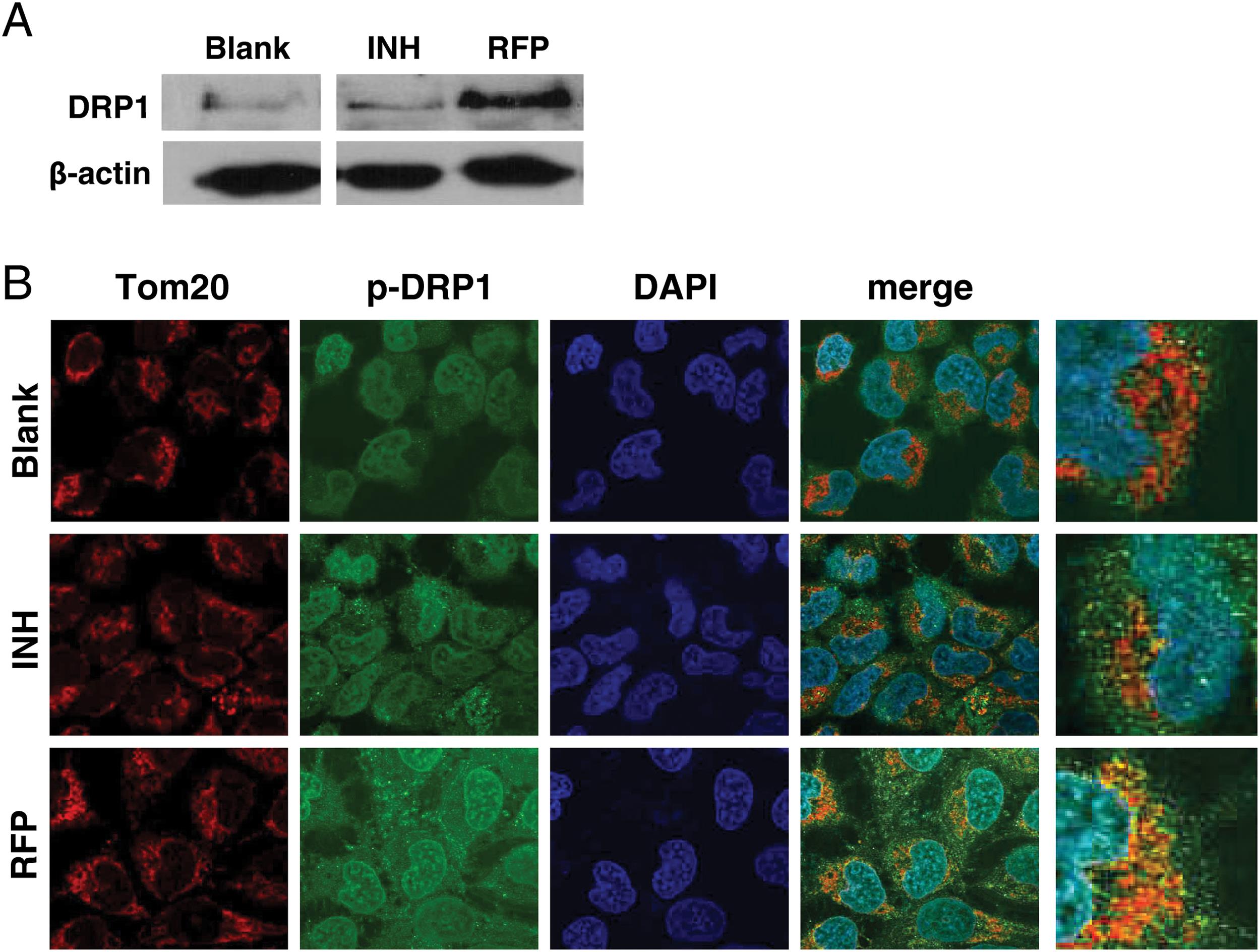 Effect of RFP and INH on the expression and activation of Drp1 in QSG7701 cells.