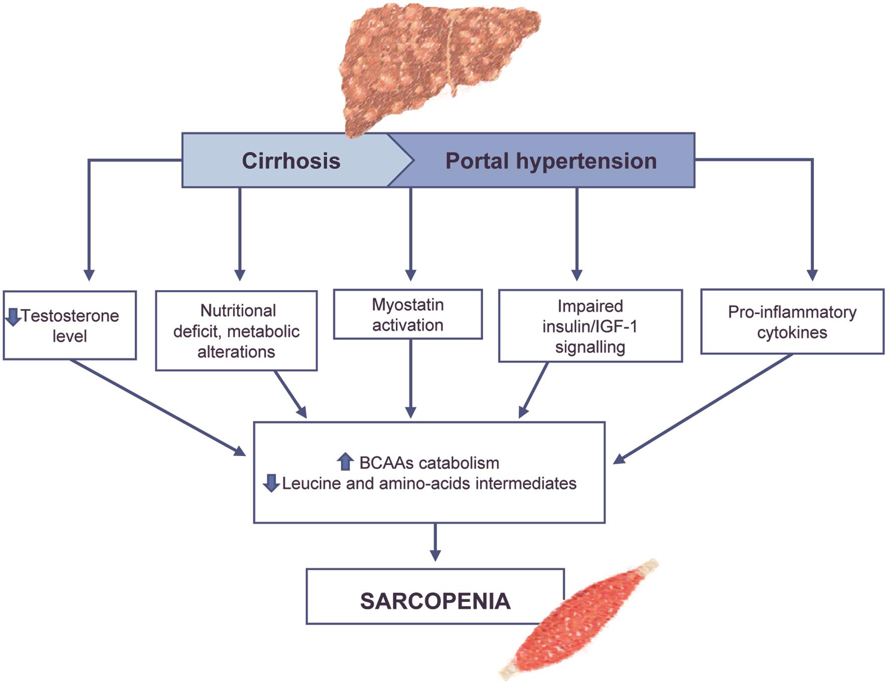 Summary of the main relevant players contributing to sarcopenia in cirrhosis:
