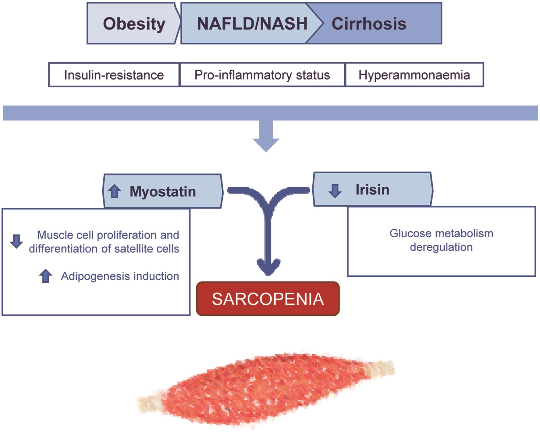 Myokines and sarcopenia in CLD: A summary of the principal derangements in myokine axis observed in patients with NAFLD.