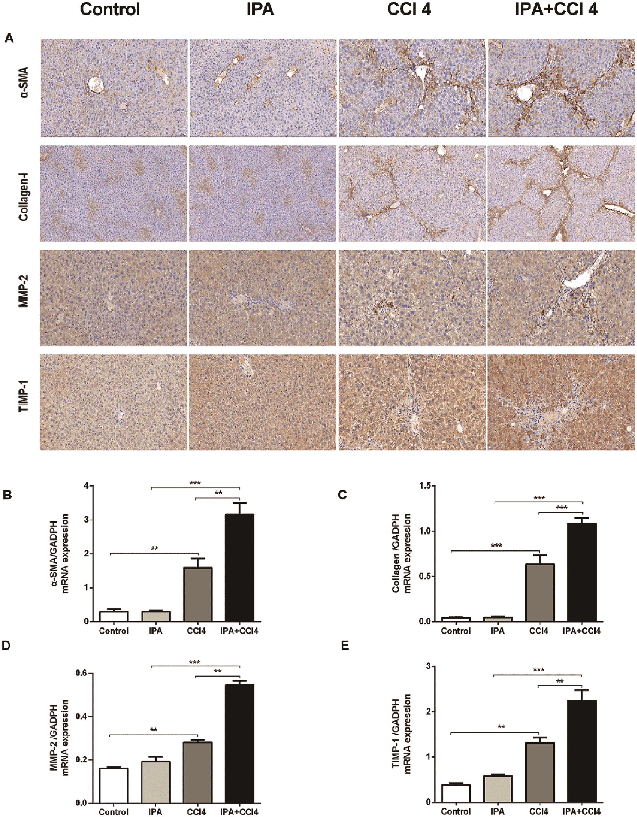 IPA promoted liver fibrosis by activating the HSCs.