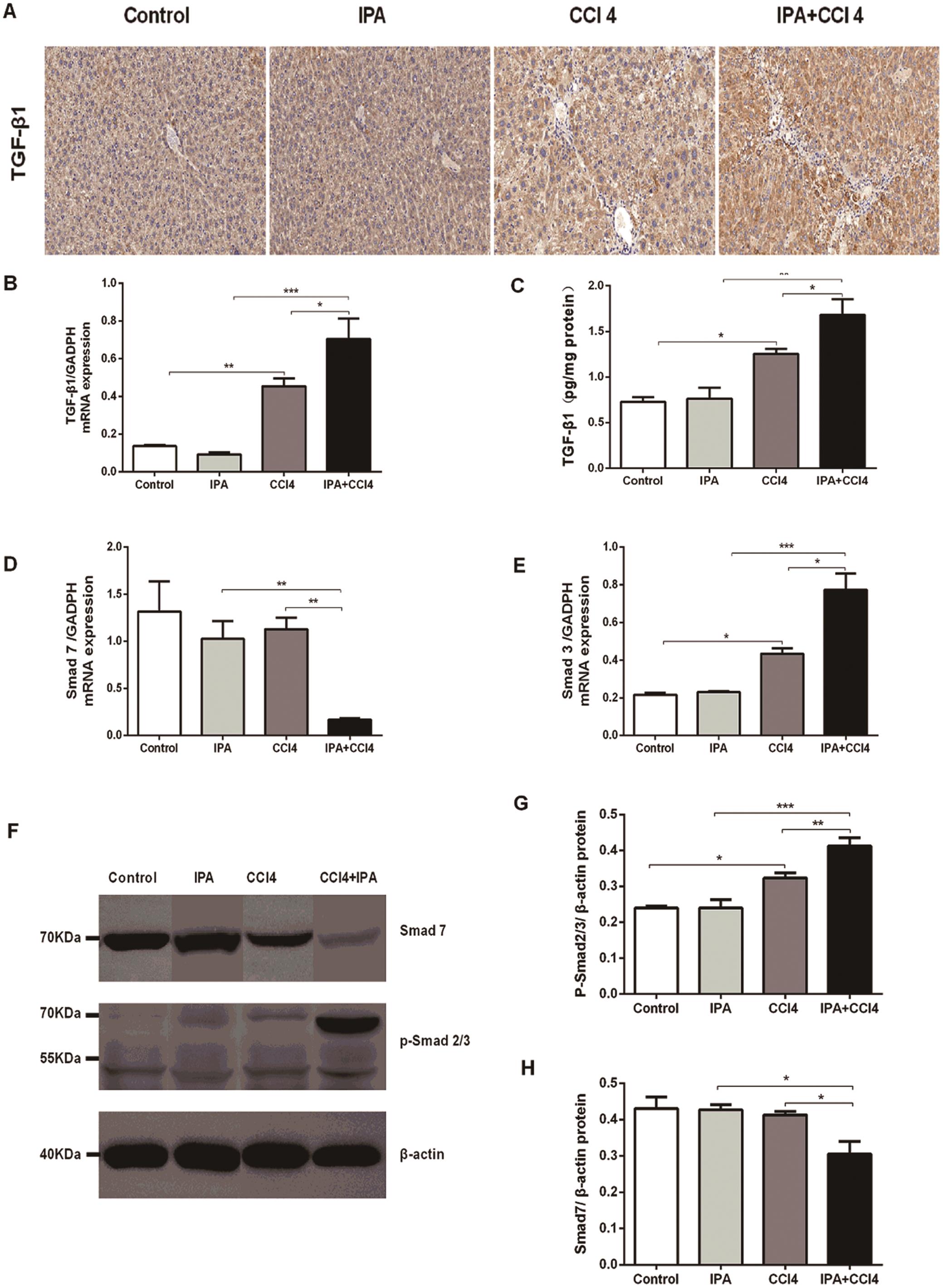 IPA promotes liver fibrosis via TGF-β1/Smads signaling.