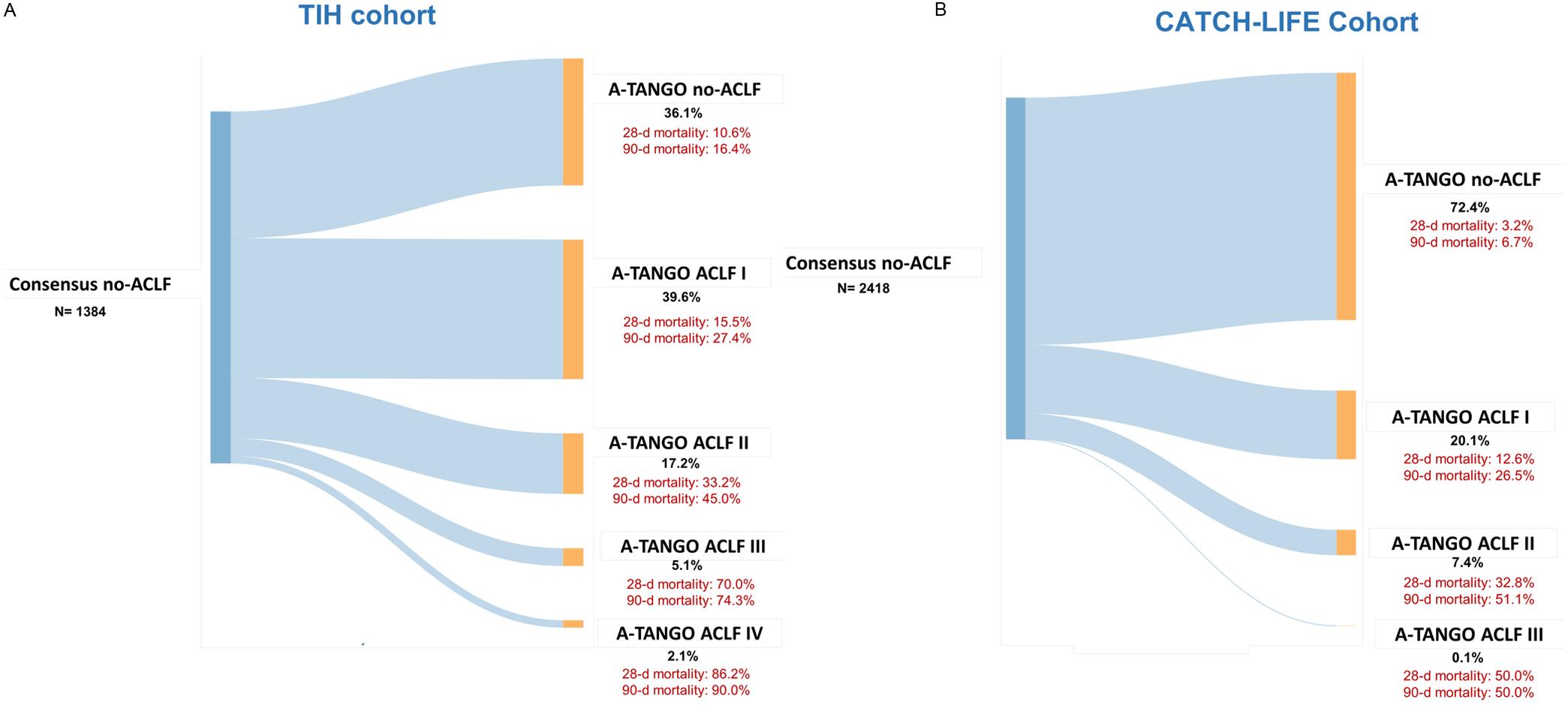A-TANGO grading refines risk stratification among patients classified as no ACLF by the consensus framework.
