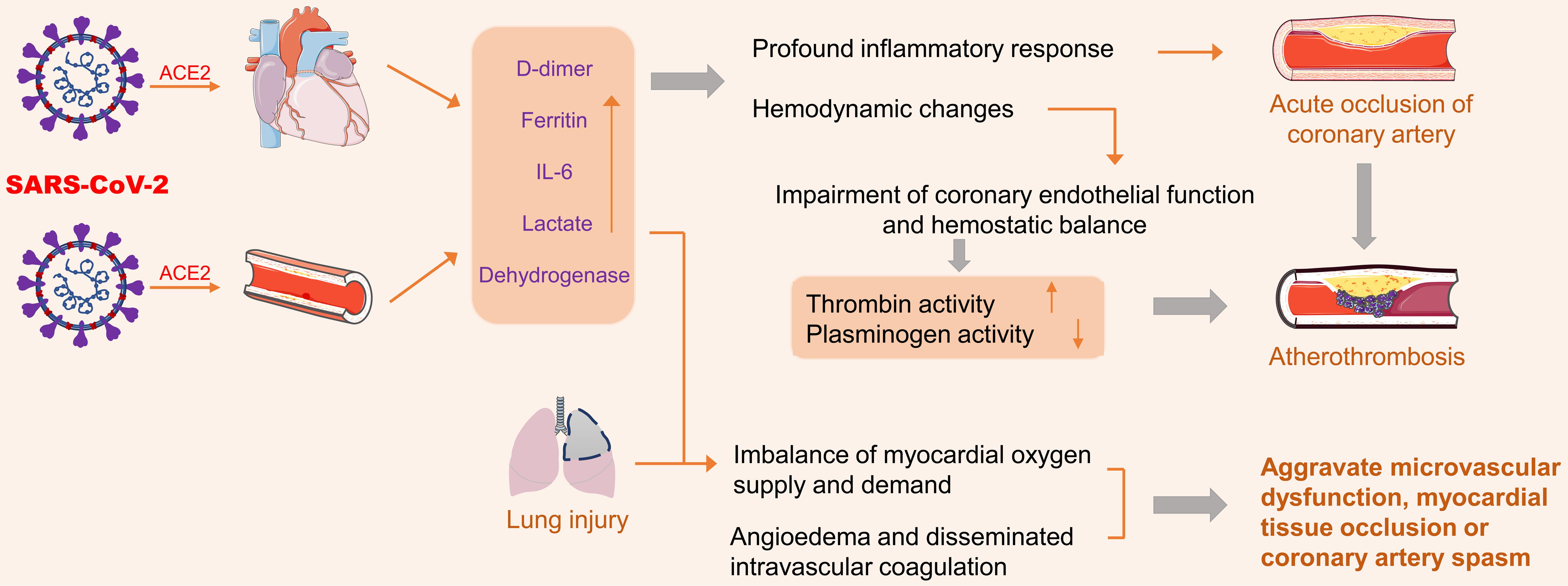 COVID-19 invades the body through a large number of ACE2 receptors in the heart and blood vessels, affecting cytokine levels and triggering an inflammatory response.
